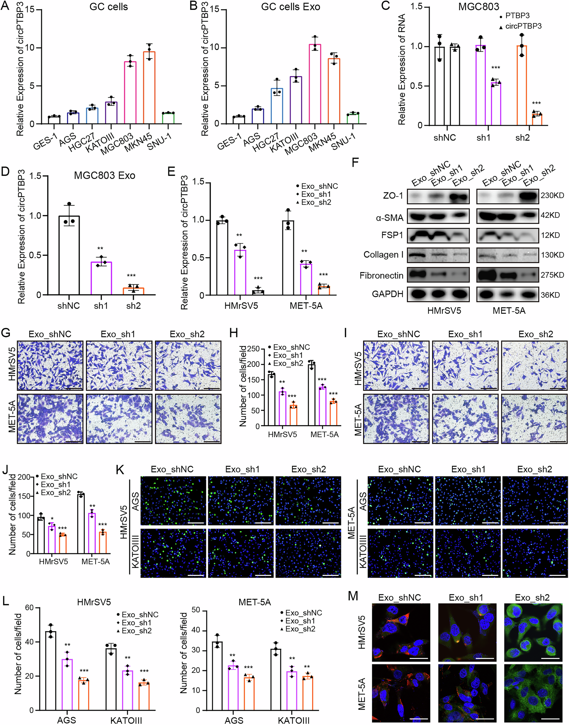 Fig. 5: Exosomes extracted from circPTBP3 knockdown GC cells could inhibit the MMT of mesothelial cells in vitro.