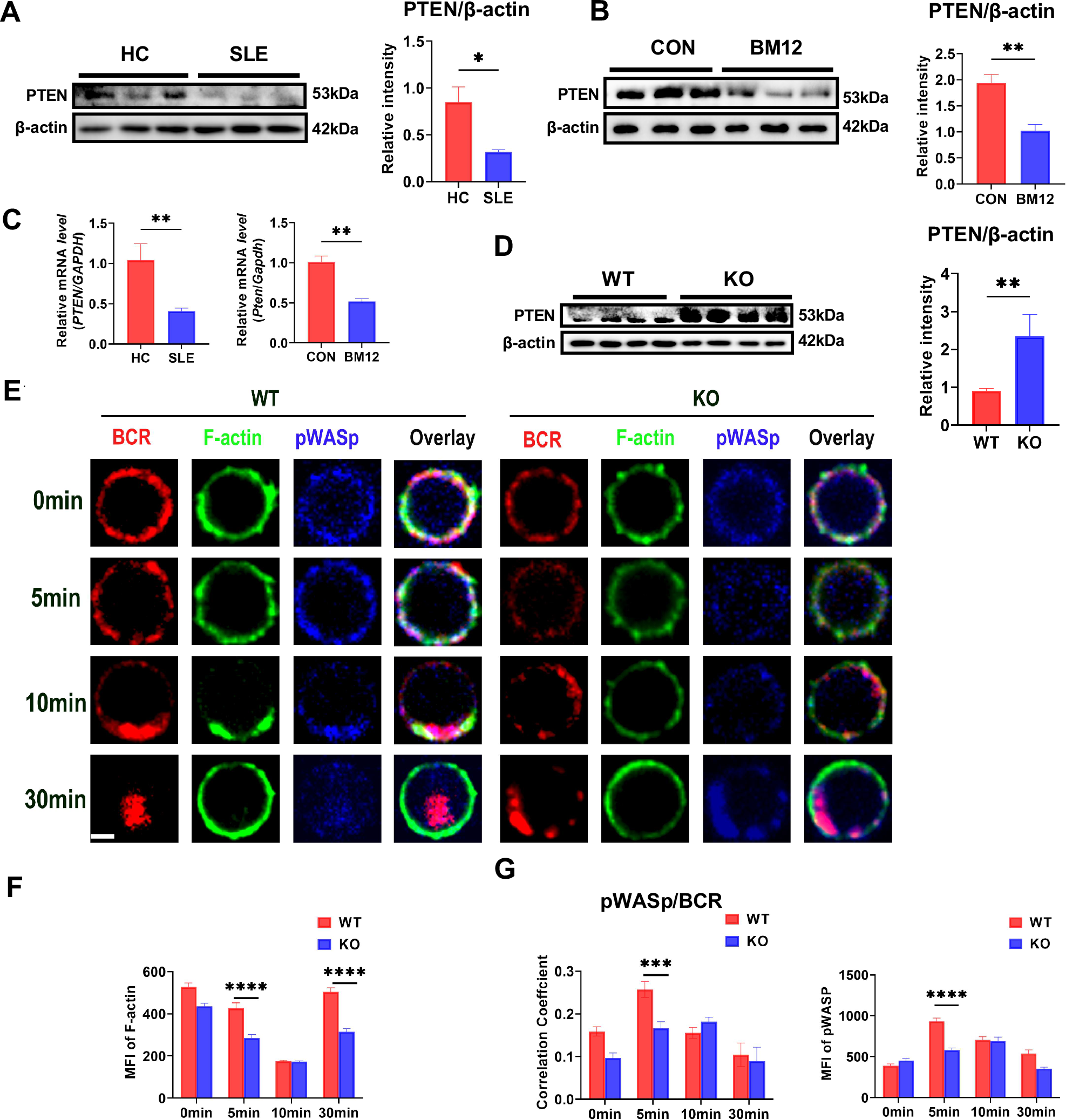 Fig. 4: Deficiency of MBD2 compromises B cell activation and BCR signaling by upregulating PTEN expression.