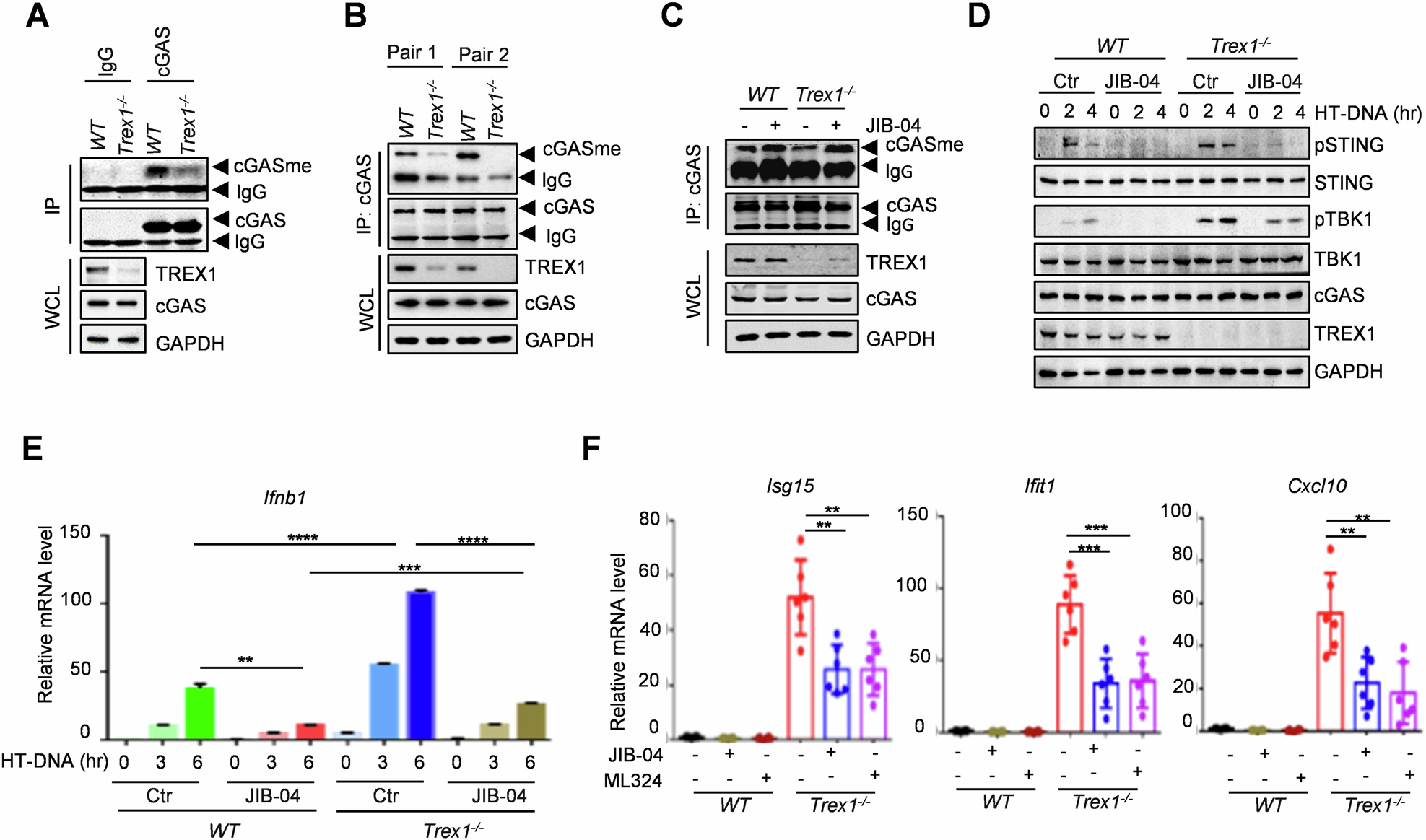 Fig. 5: KDM4B inhibition blocks the hyperactivation of cGAS in autoimmune disease.