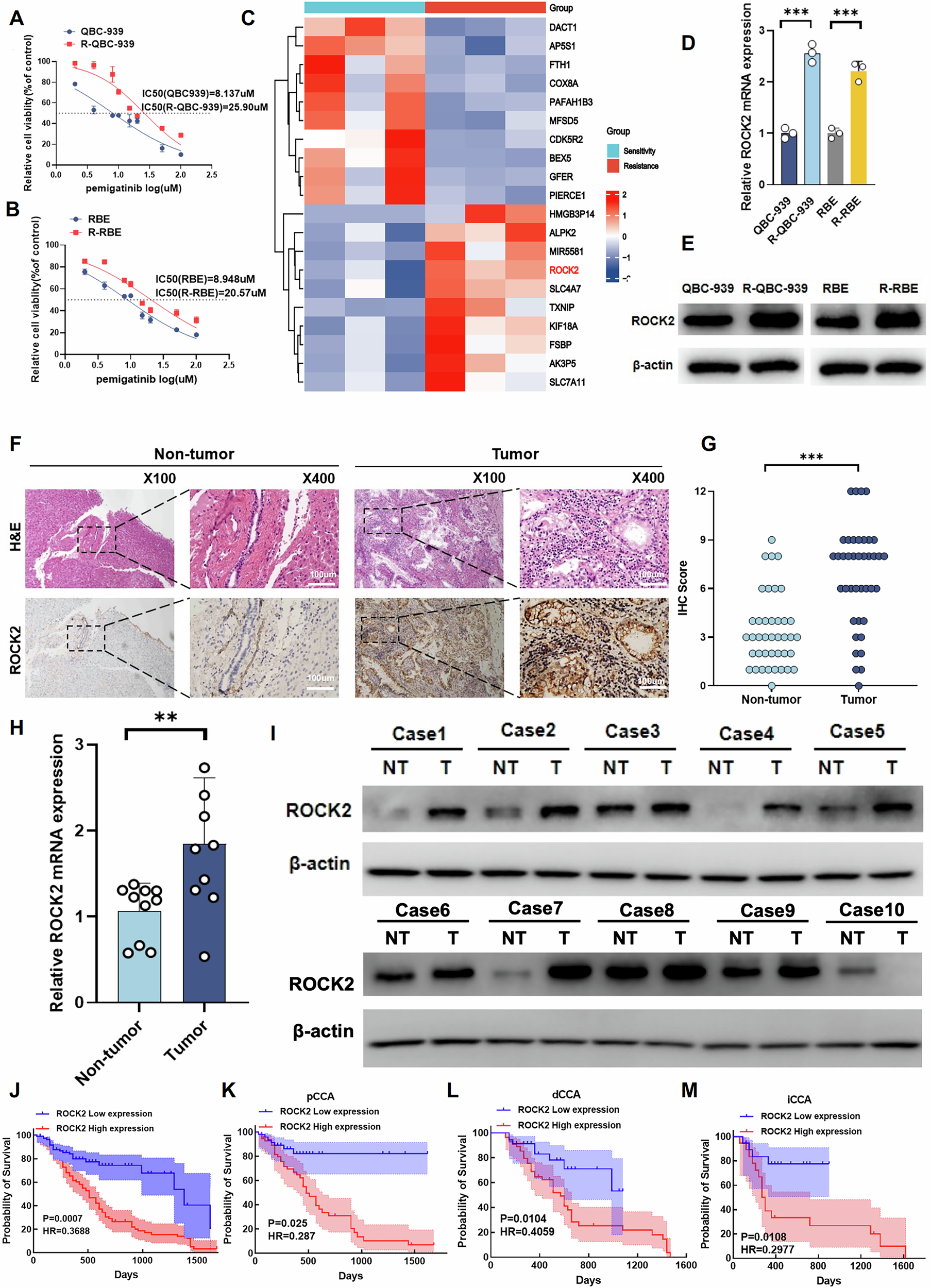 Fig. 1: ROCK2 is strongly expressed in pemigatinib-resistant CCA cells and plays a key role in the poor prognosis of patients with CCA.