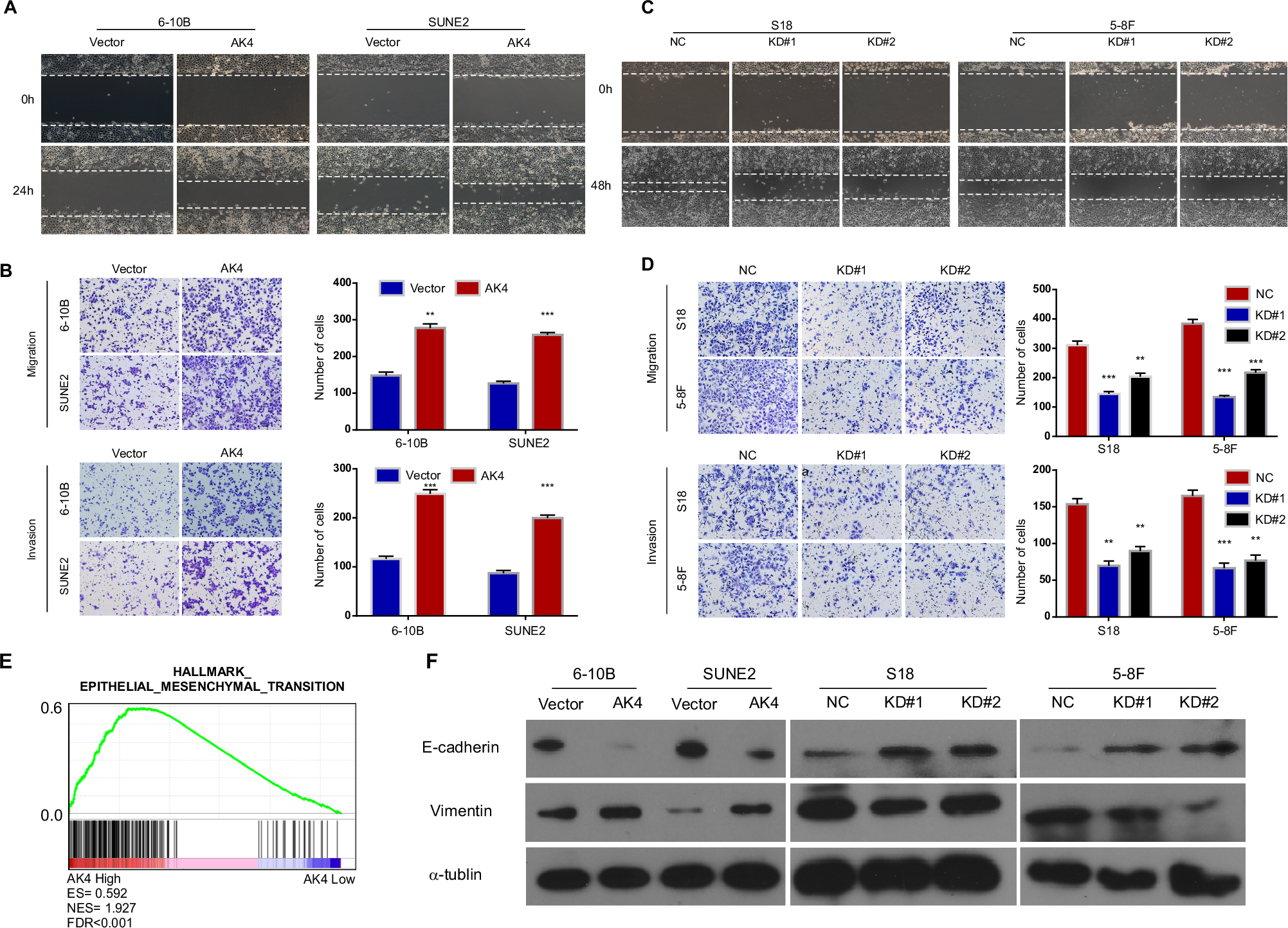 Fig. 3: AK4 promotes the migration, invasion, and EMT of NPC cells in vitro.