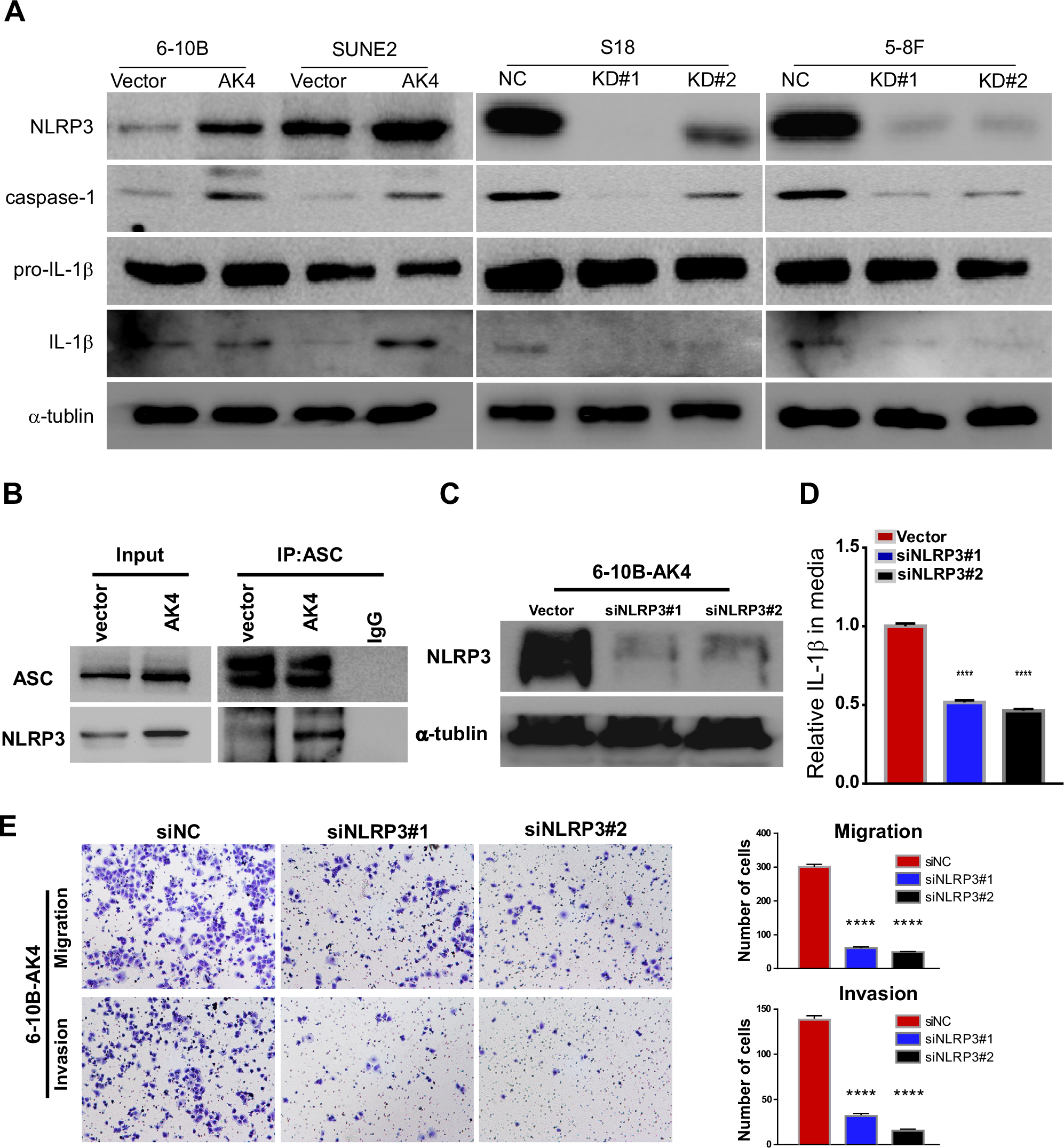 Fig. 7: AK4 induces IL-1β secretion by activating the NLRP3 signaling pathway.