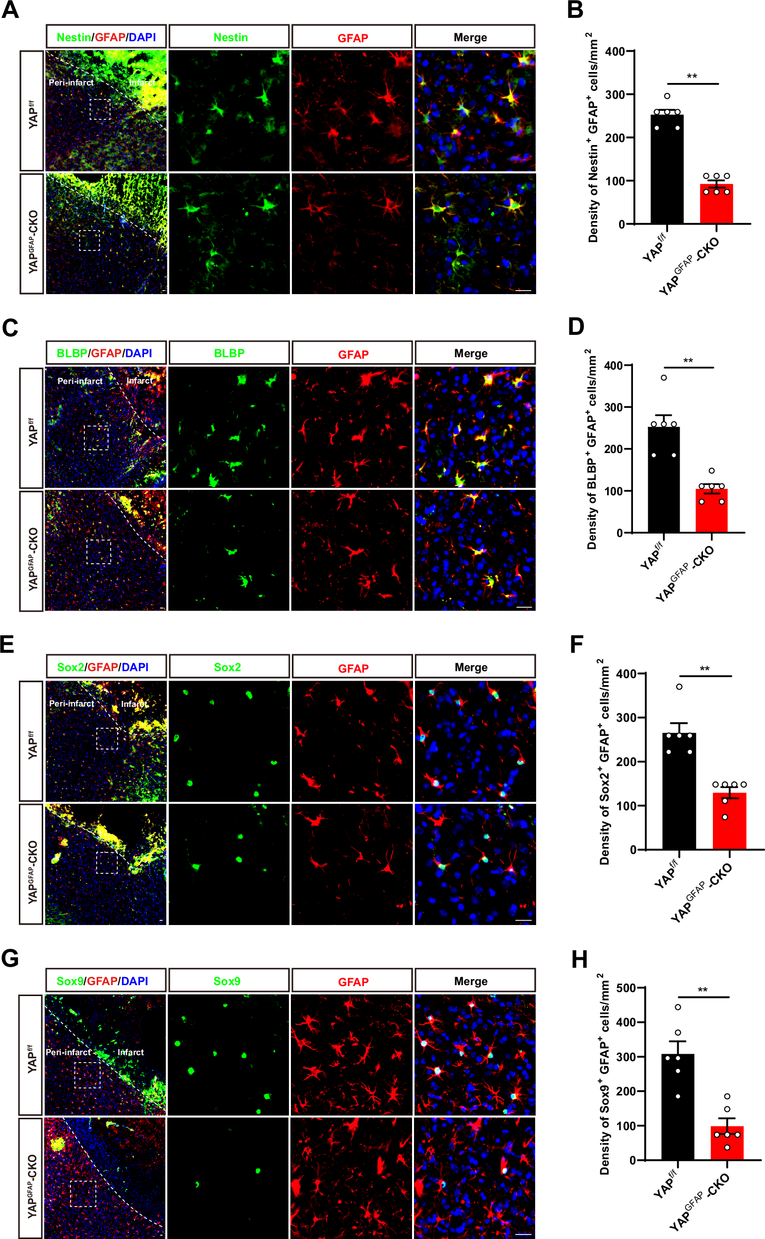 Fig. 5: YAP deletion in astrocytes suppressed astrocytic activation, and inhibited the gain of stemness in astrocytes induced by IS in mice.