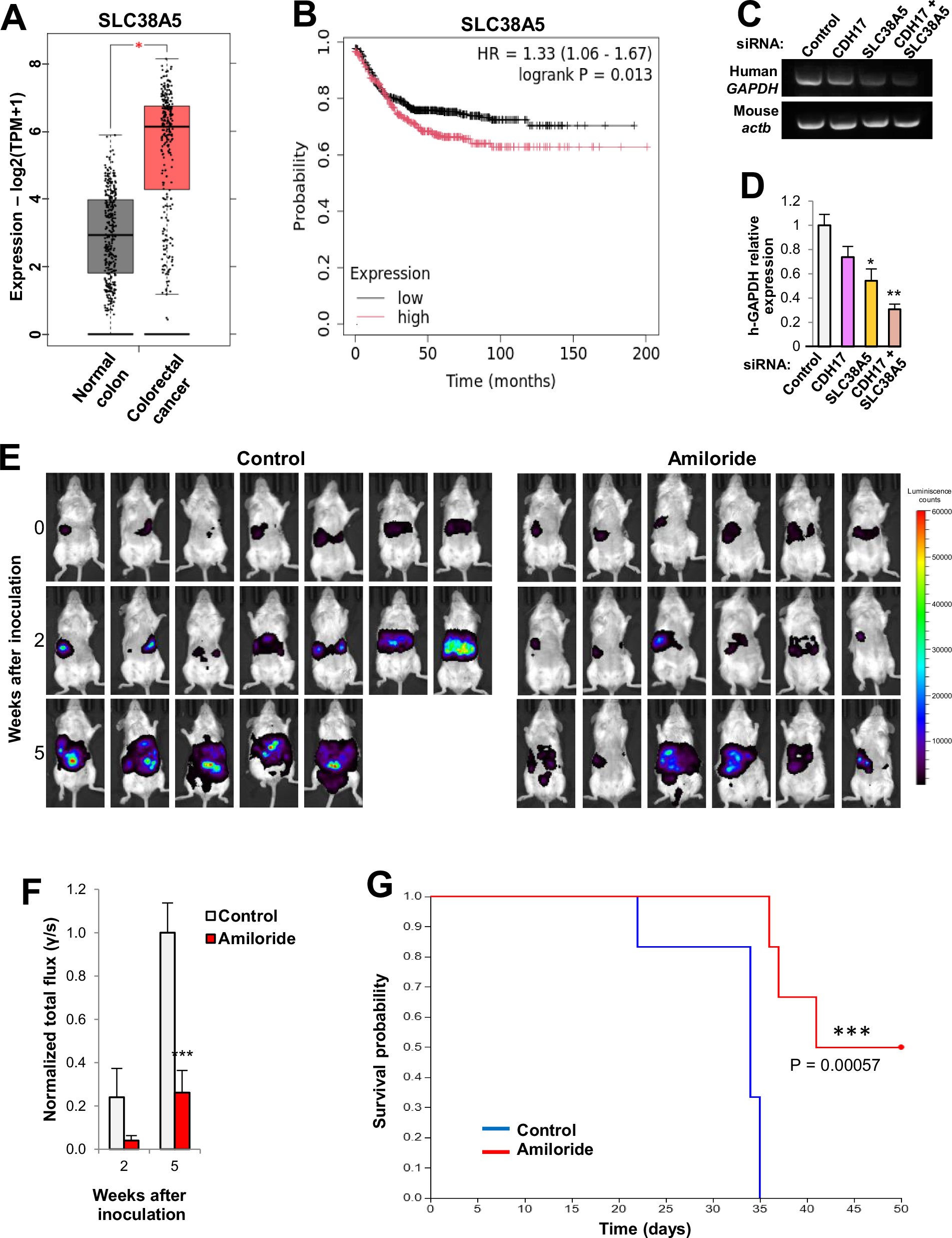 Fig. 7: Inhibition of SLC38A5 reduces liver metastasis of colorectal cancer cells.