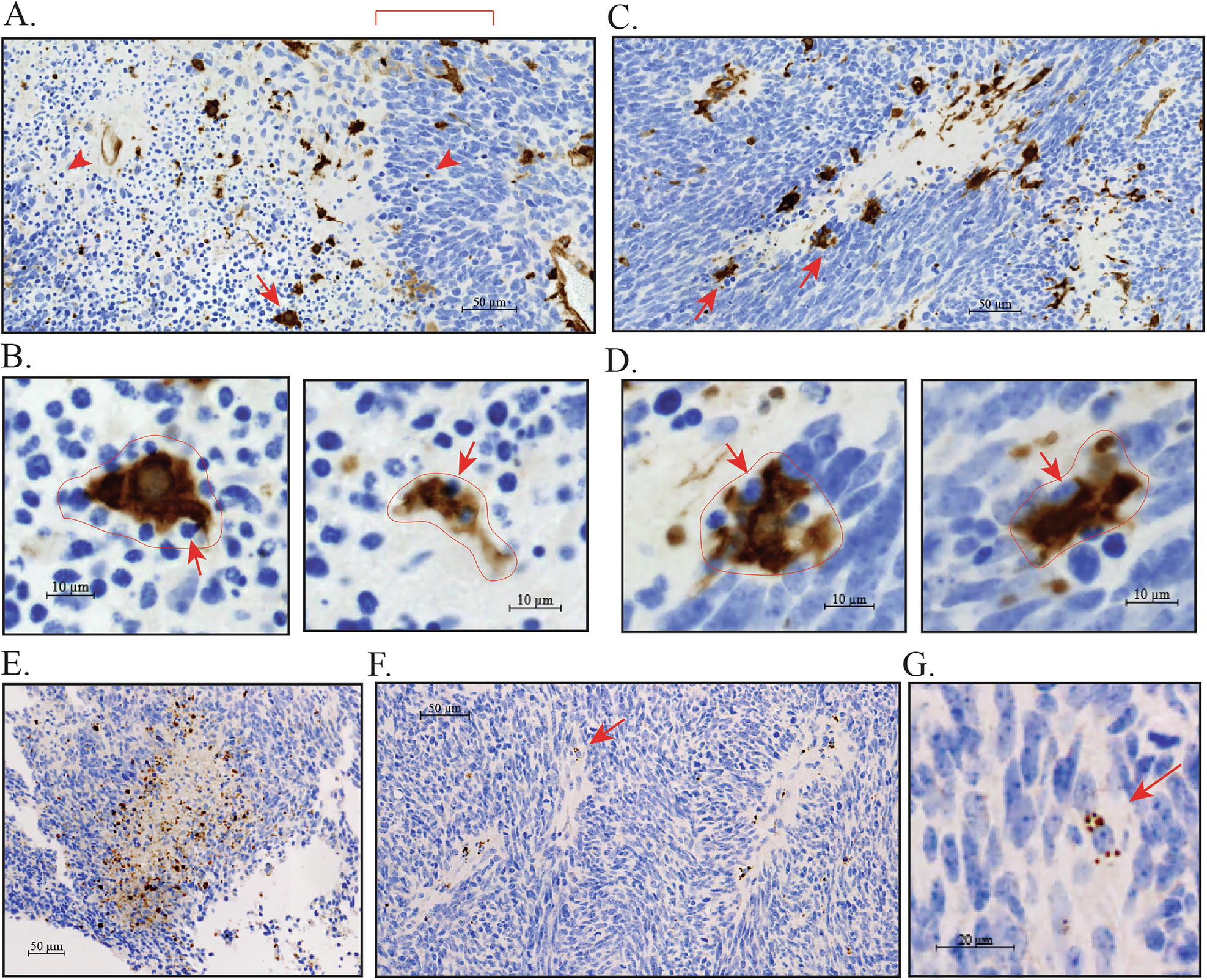 Fig. 3: TGM2 staining in necrotic regions of the xenograft.