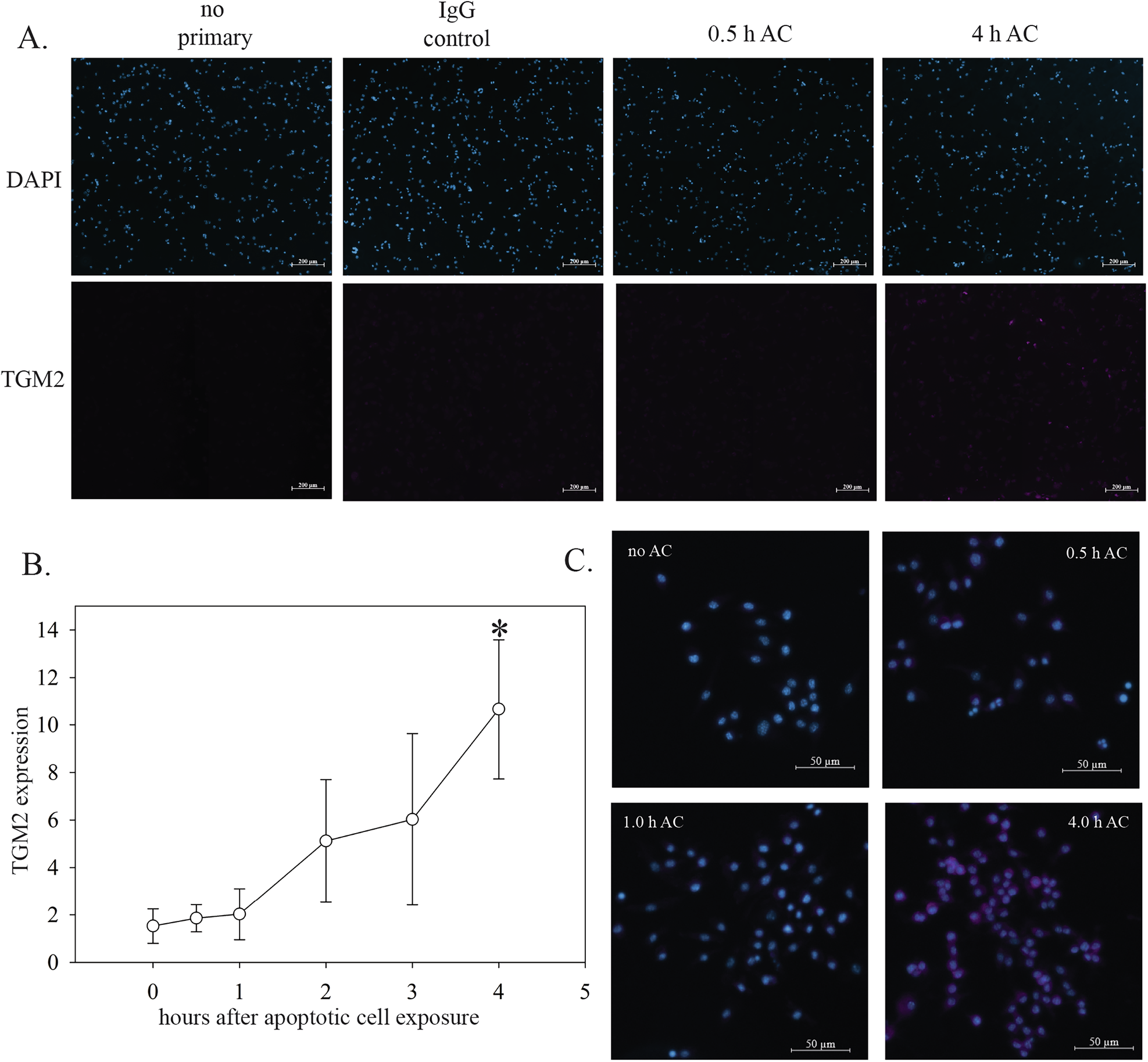Fig. 5: TGM2 expression during macrophage efferocytosis in cell culture.