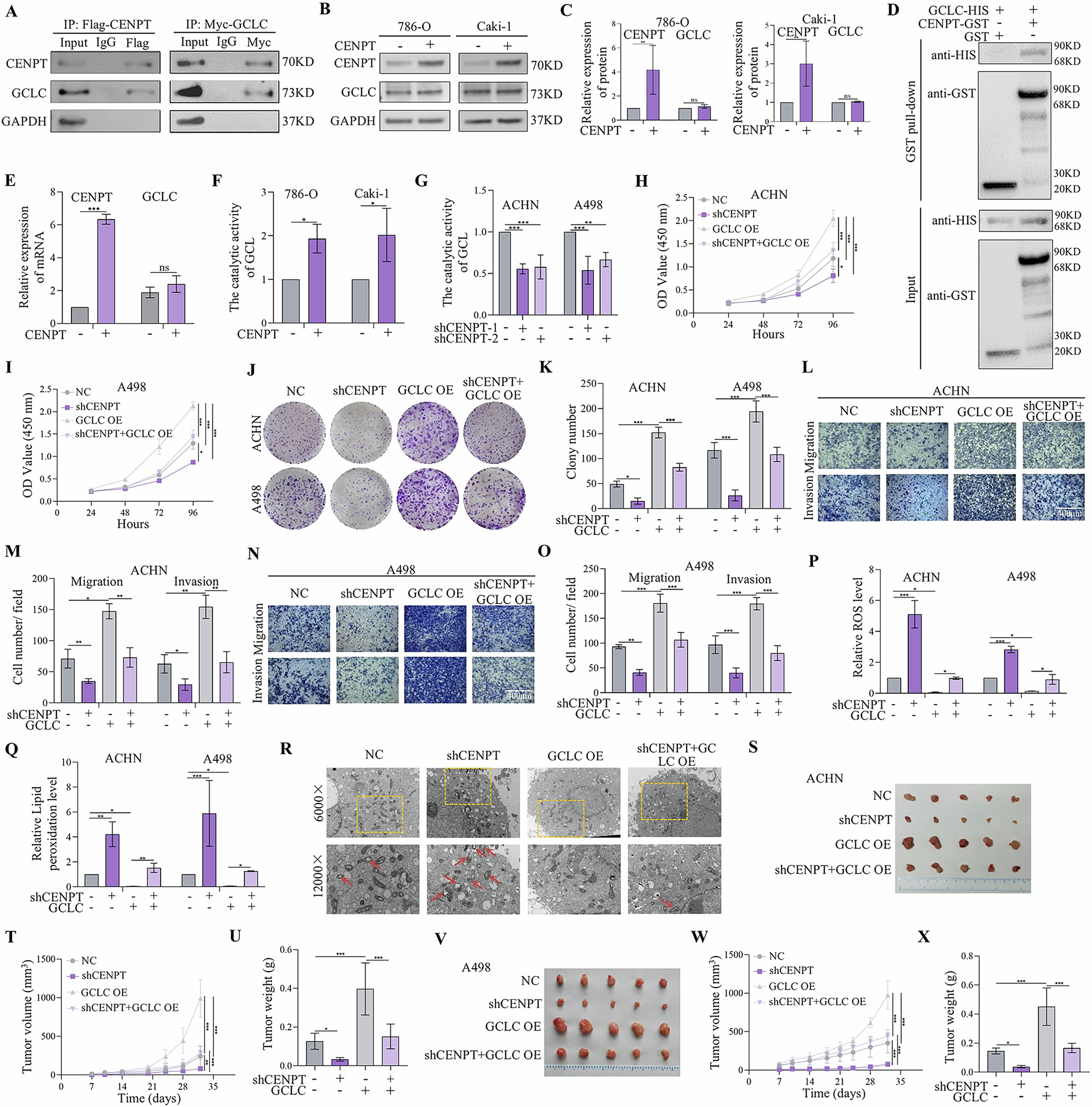 Fig. 4: CENPT promoted RCC tumor proliferation and metastasis by increasing GSH synthesis in vitro and in vivo.