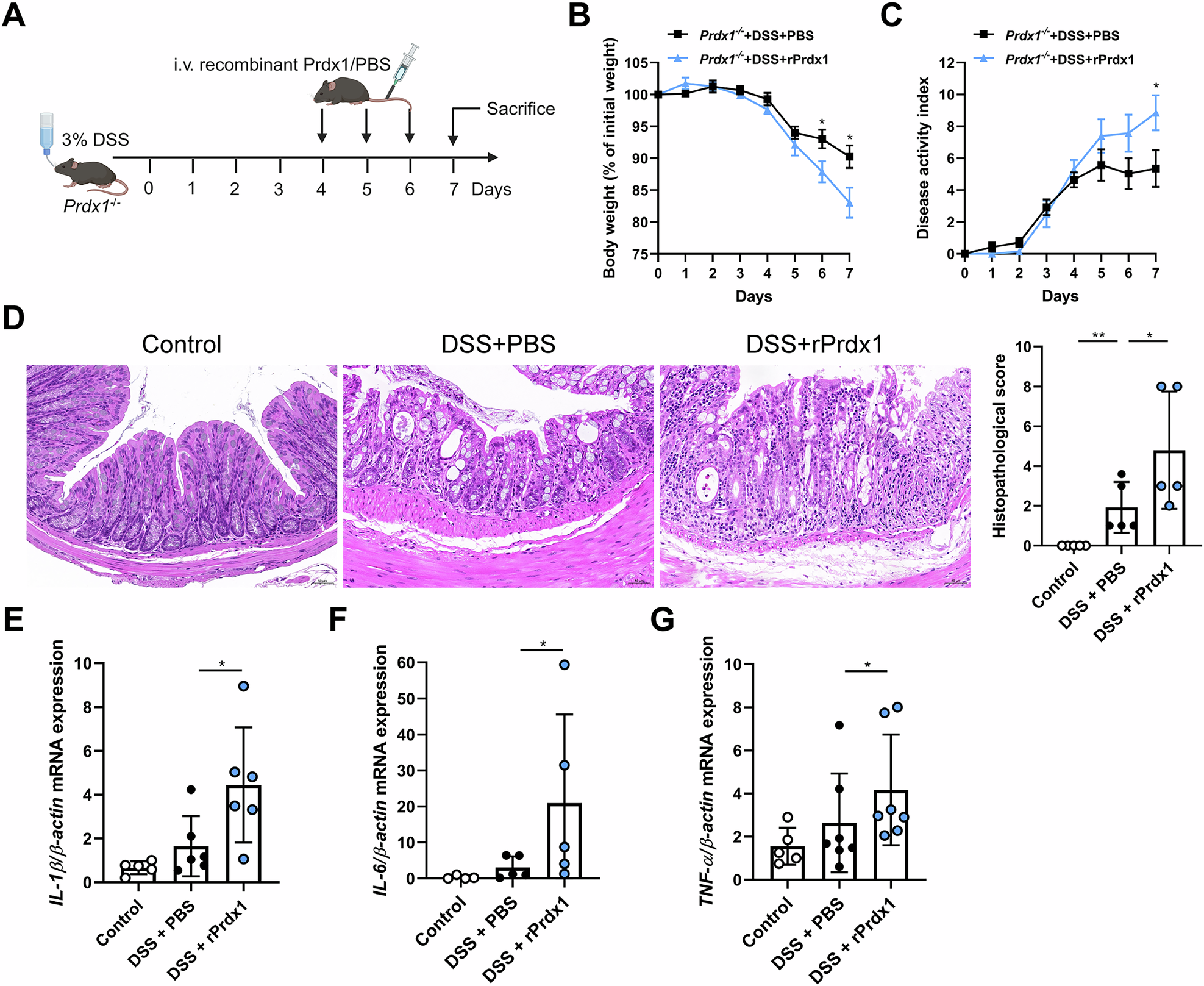 Fig. 5: Reintroduction of recombinant Prdx1 (rPrdx1) facilitated intestinal inflammation.