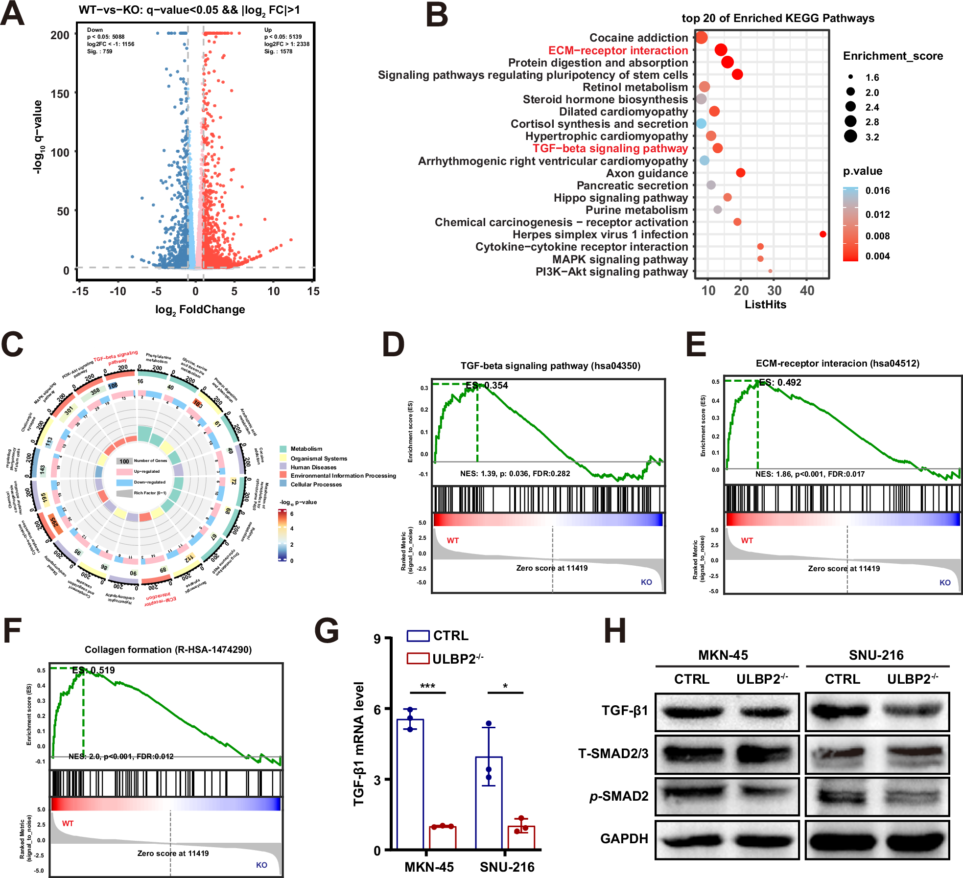 Fig. 3: ULBP2 activates TGF-β signalling and collagen formation in GC.