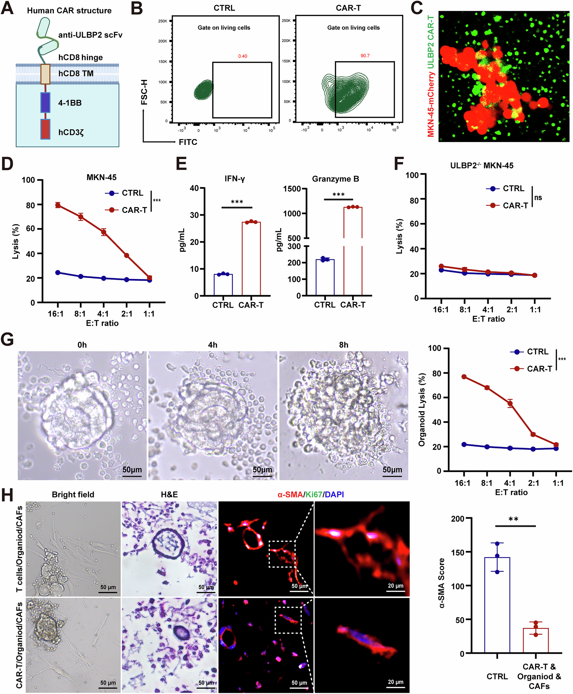 Fig. 5: ULBP2 CAR-T cells specifically eliminate GC cells and organoids.