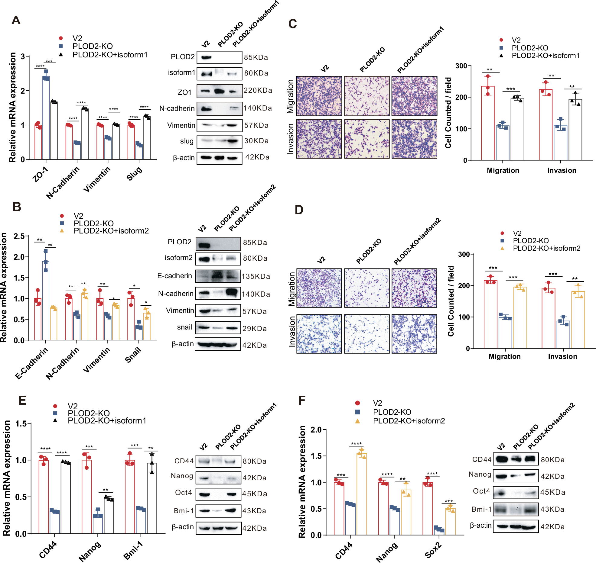 Fig. 6: Both DCLK1-L variants are essential for hypoxia-PLOD2-driven cancer invasiveness and stemness.