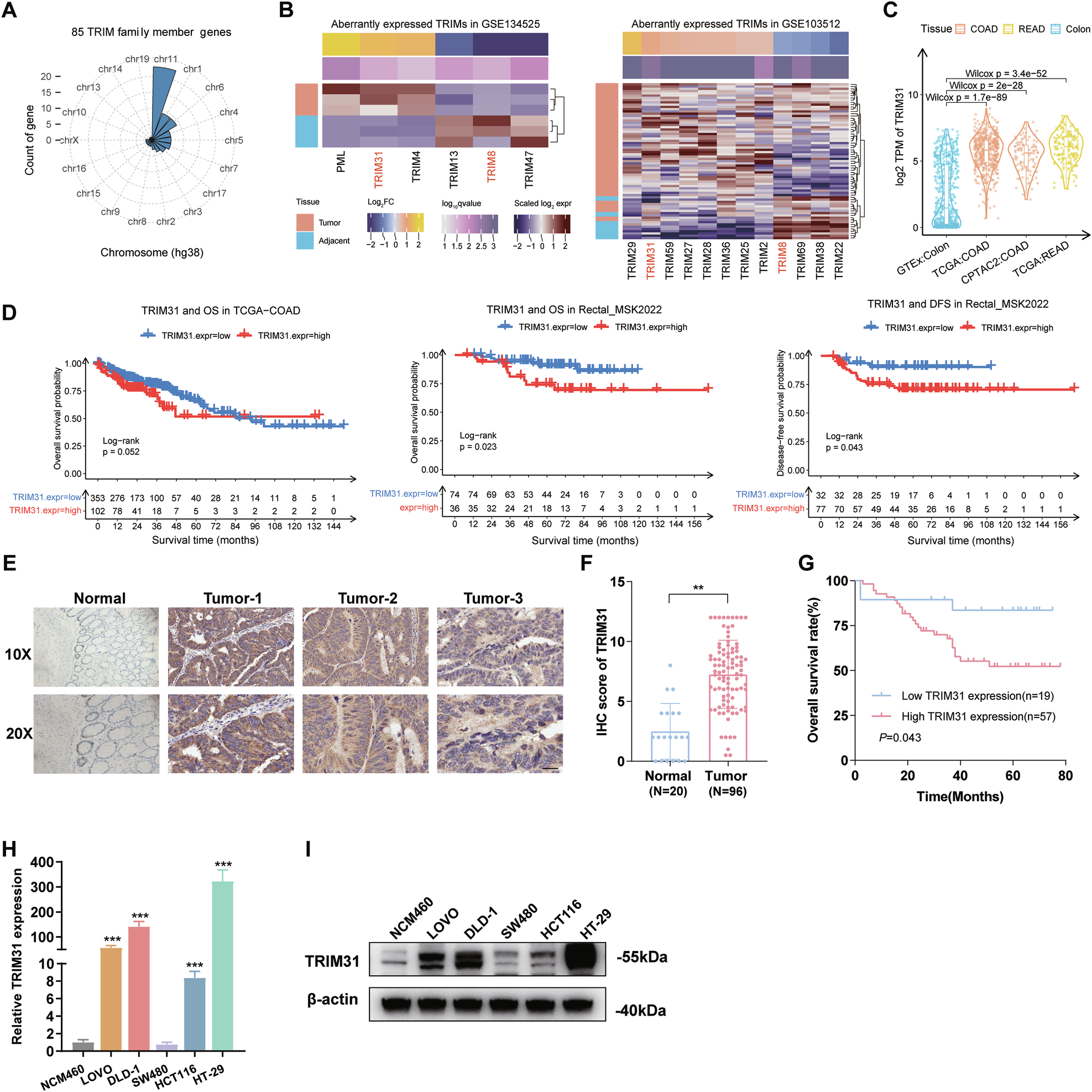 Fig. 1: Aberrantly activated expression of TRIM31 and its negative association with prognostic outcome in CRC.