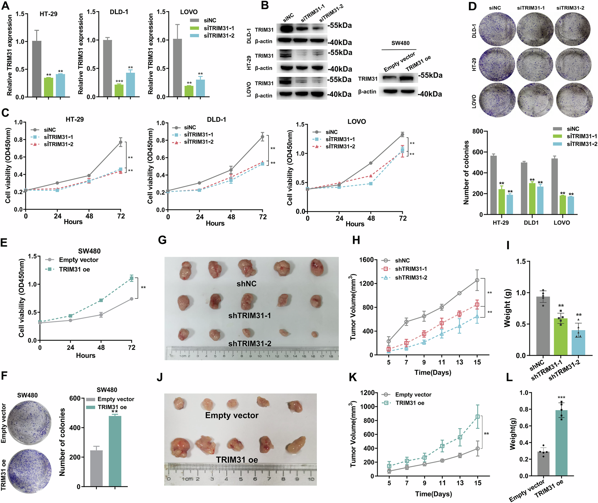 Fig. 2: Knockdown of TRIM31 inhibits CRC proliferation in vitro and in vivo.