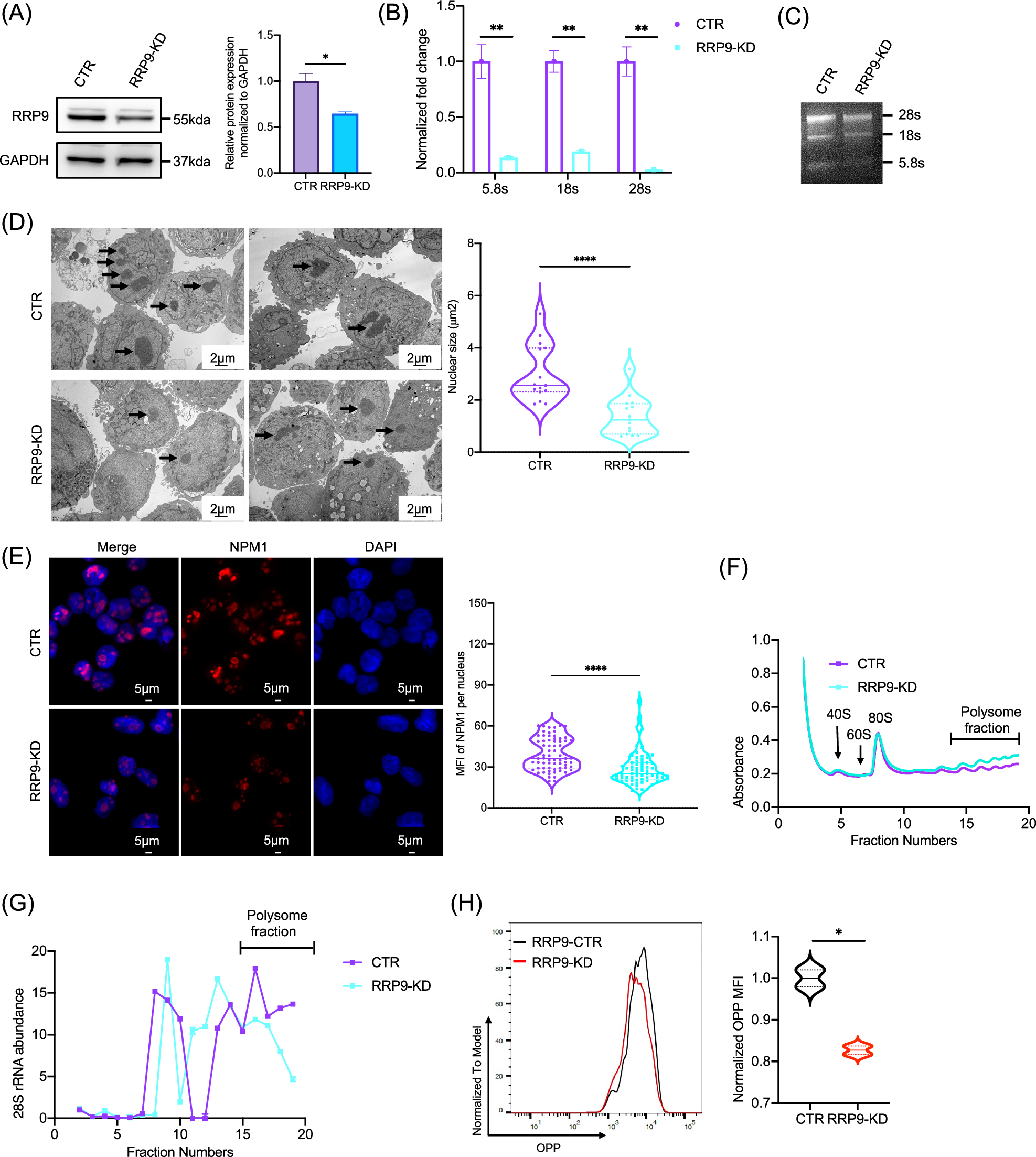 Fig. 6: RRP9 regulates ribosome biogenesis in AML cells.