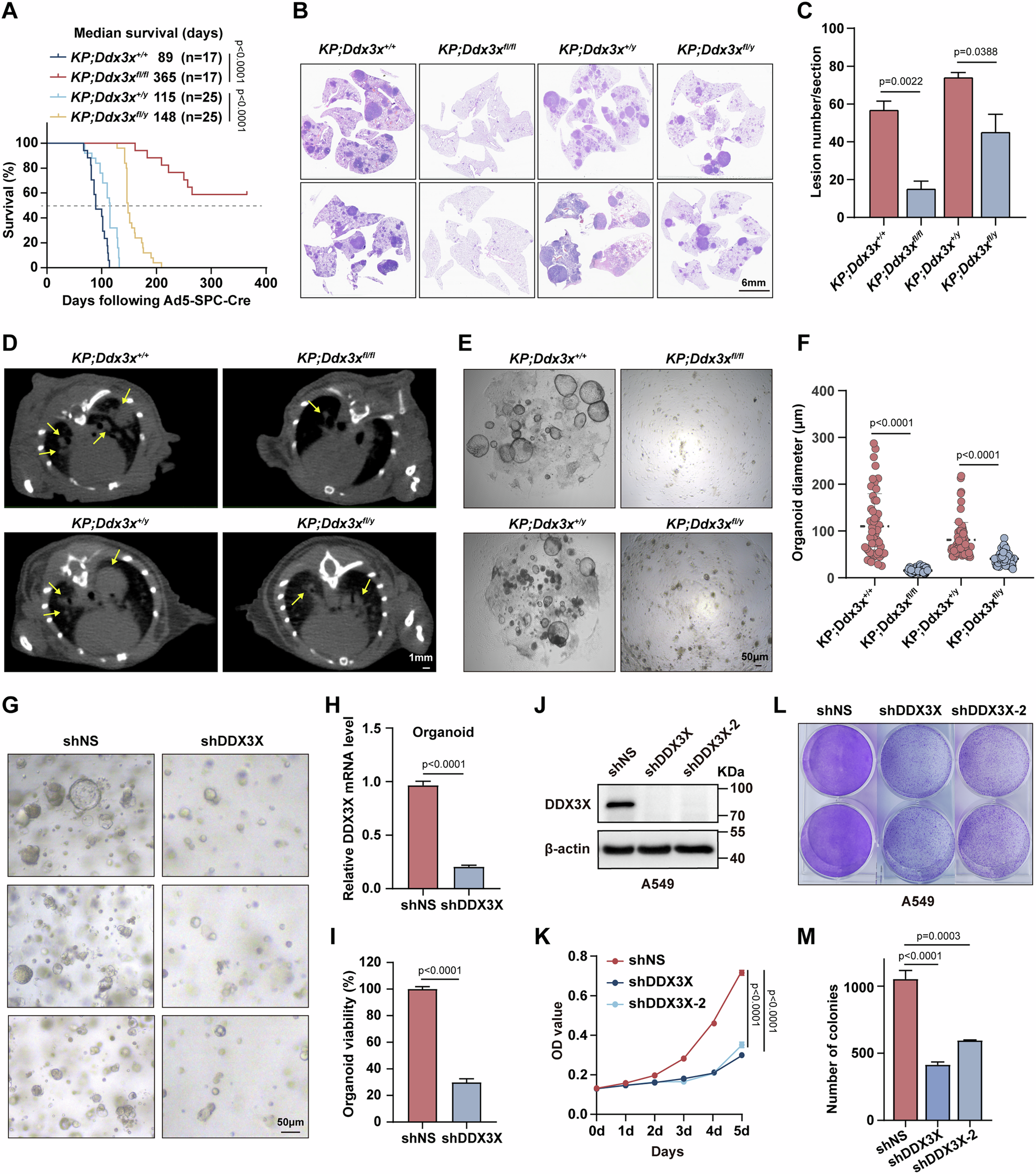 dr kwon ultra glutathione review Targeting DDX3X suppresses progression of KRAS-driven lung cancer by disrupting antioxidative homeostasis and inducing ferroptosis