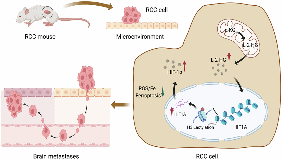Novel role of L-2-HG in regulating HIF1A signaling pathway and iron death  resistance in renal cancer brain metastasis