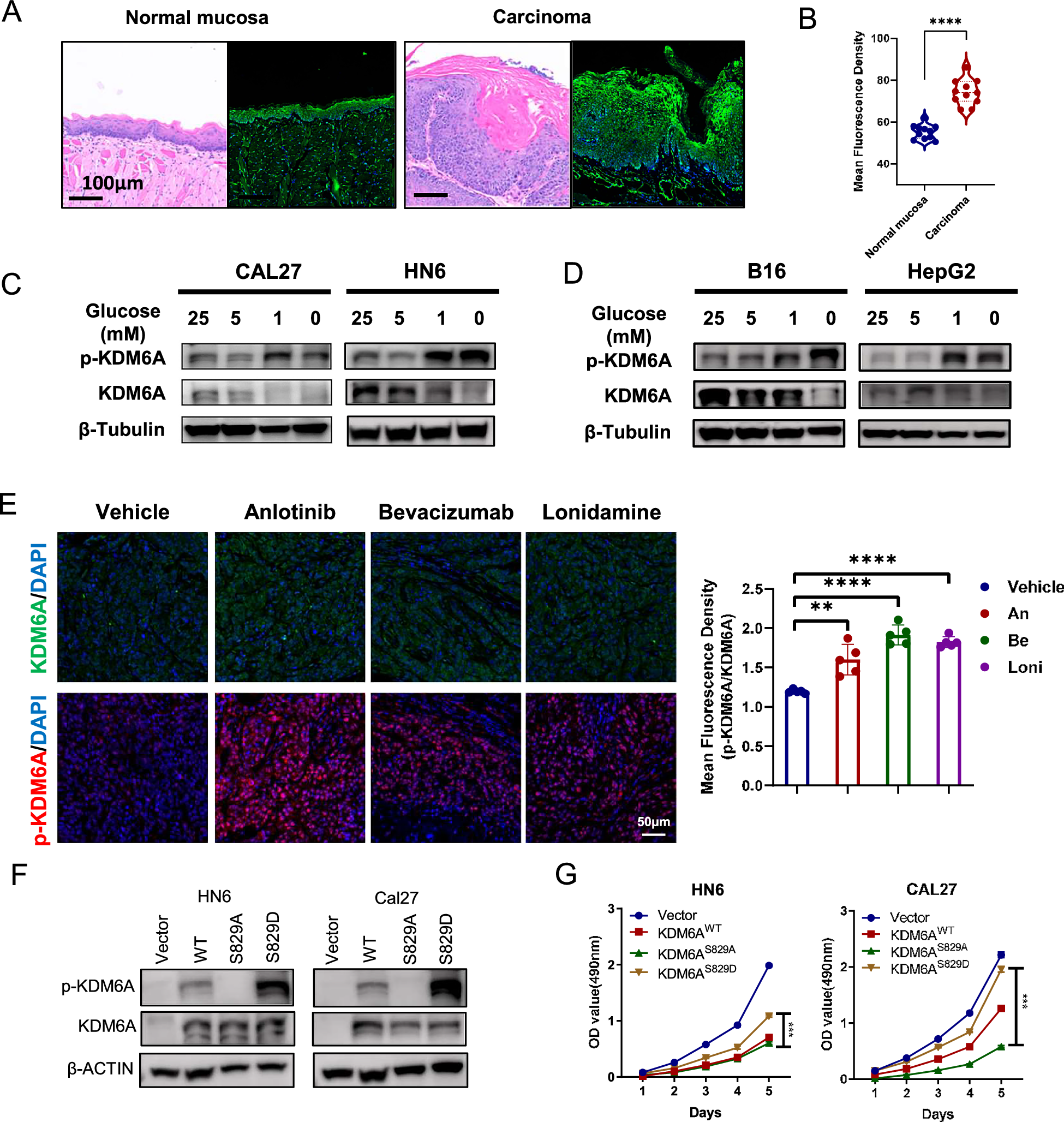Fig. 2: KDM6A-pSer829 promotes tumor proliferation.