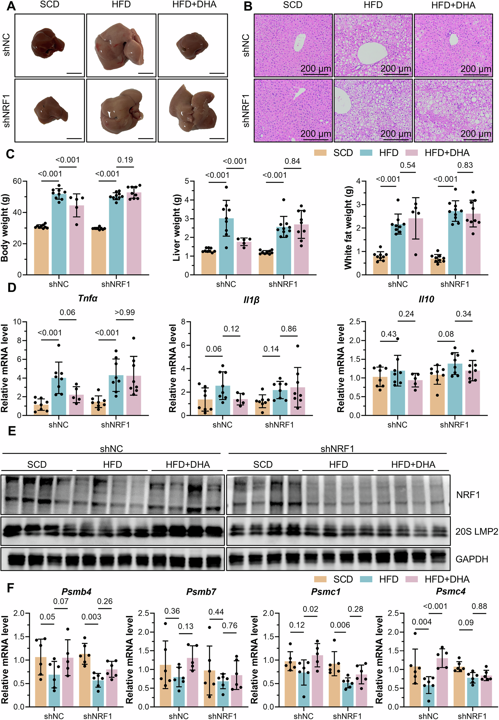Fig. 5: Liver-specific knockdown of NRF1 reversed the protective effect of DHA against MASH.