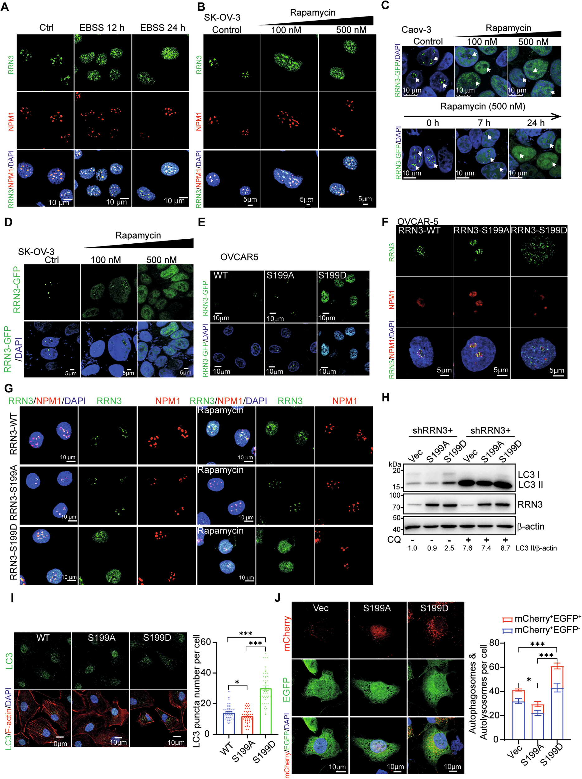 Fig. 4: Nutrient stress diverts RRN3 out of nucleolus by phosphorylation at S199 residue.