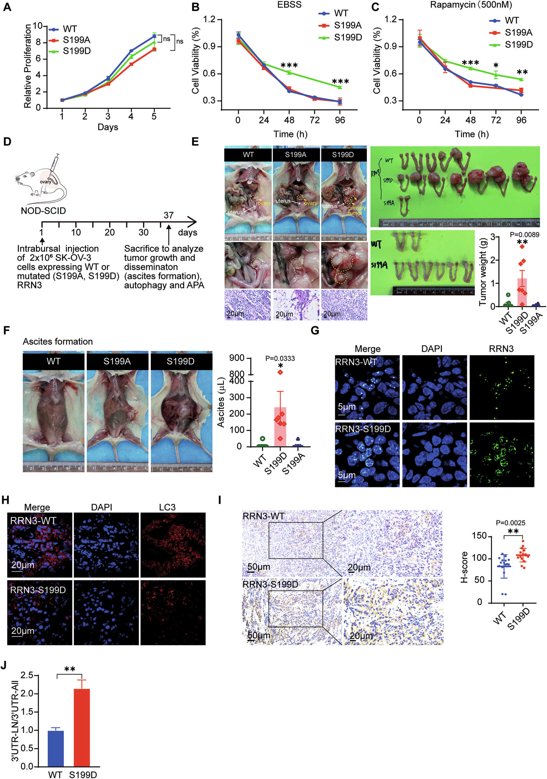 Fig. 7: RRN3-regulated autophagy is essential for OC progression.