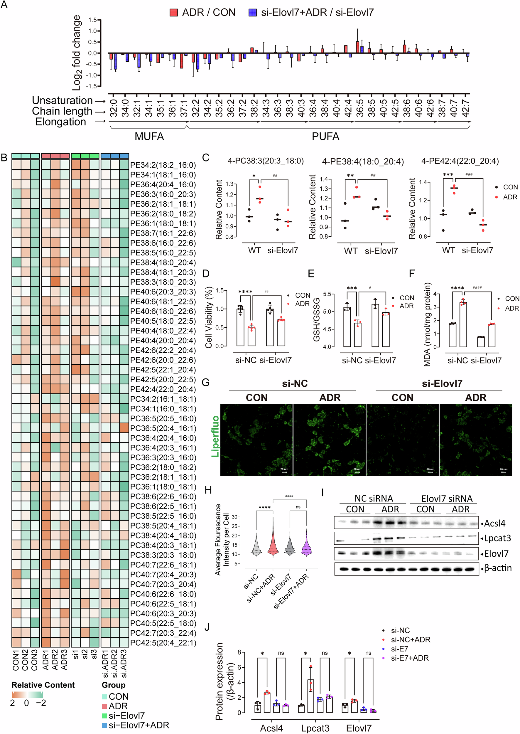 Fig. 5: Elovl7 knockdown mitigated the elevation of LC-PUFA-PLs in injured podocytes and reduced podocyte ferroptosis.