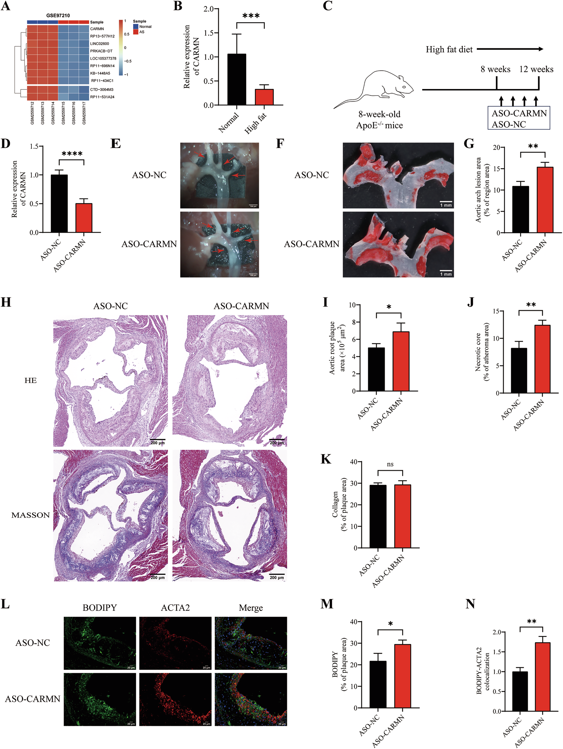 Fig. 1: Silencing CARMN promotes atherosclerosis and VSMC-derived foam cell formation.