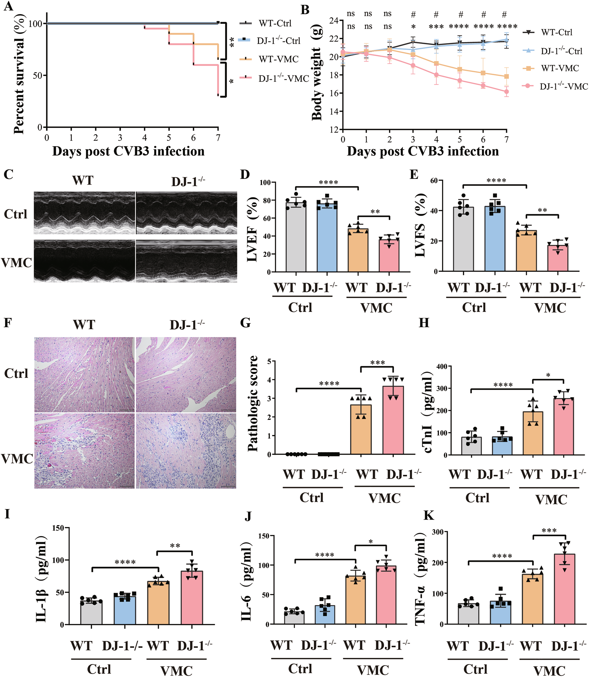 Fig. 2: DJ-1 deletion aggravates CVB3-induced myocardium injury.