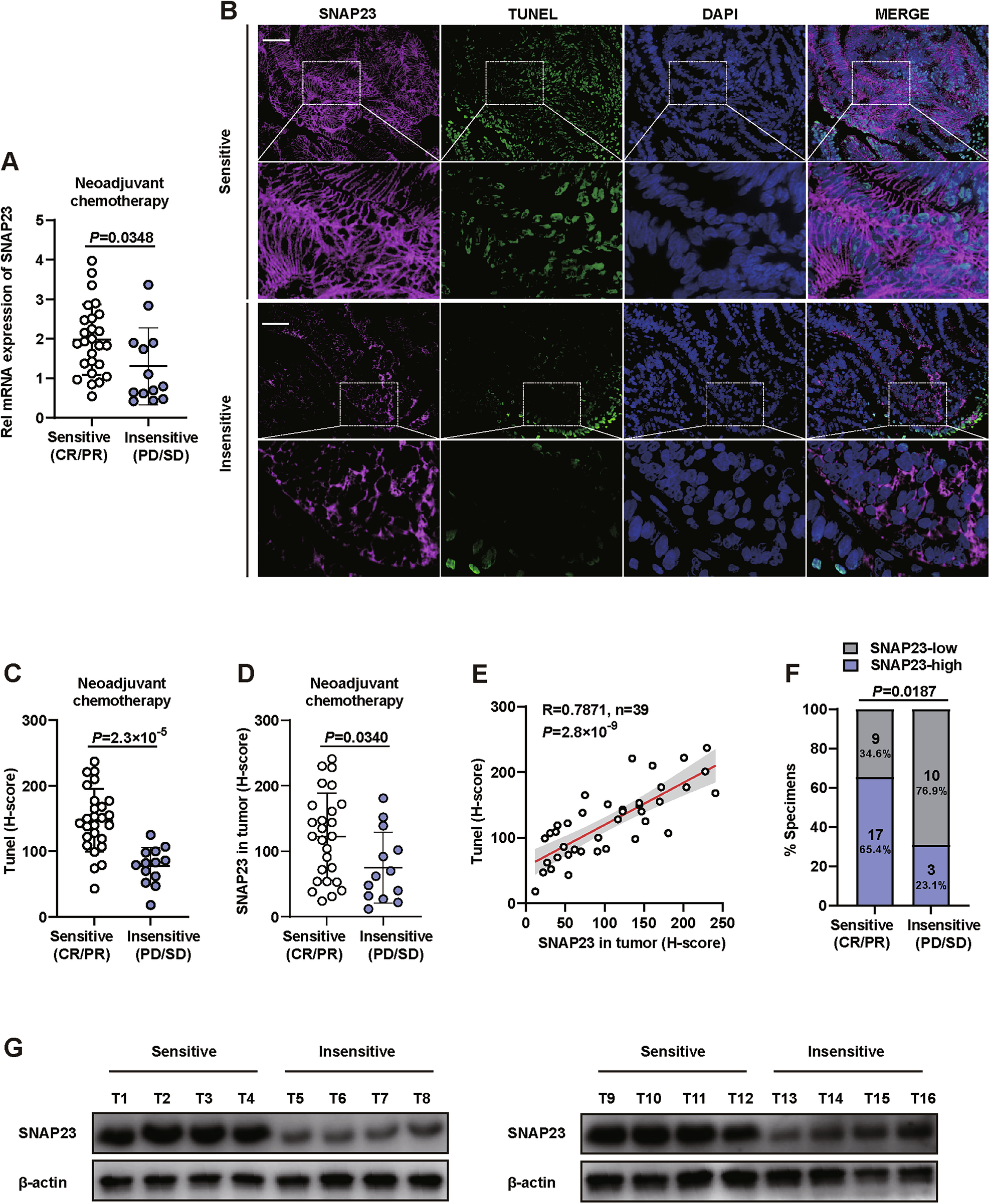 Fig. 1: Clinical significance of SNAP23 expression in colorectal cancer (CRC).