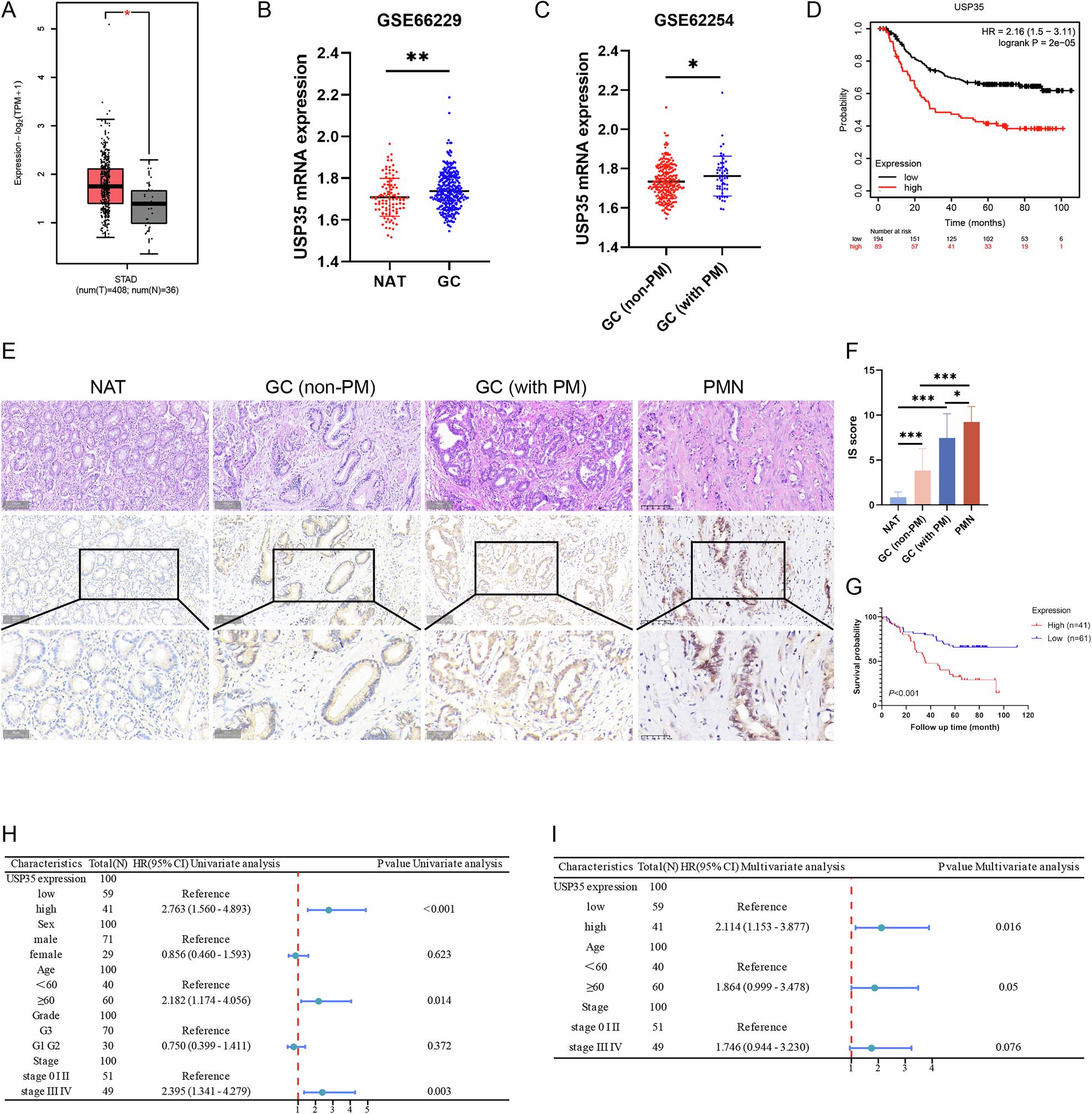 Fig. 1: USP35 expression characteristics in GC.