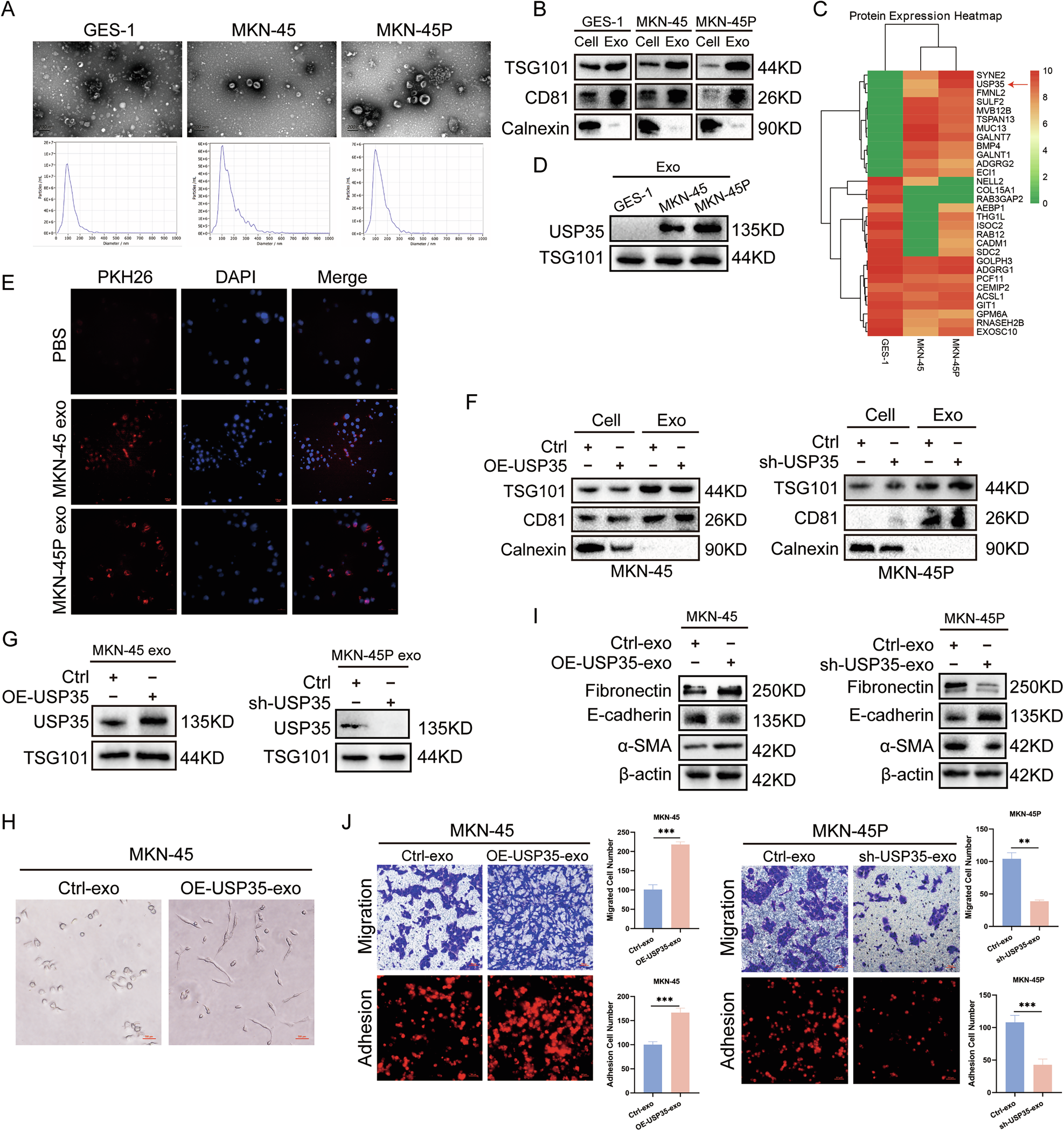 Fig. 5: Exosome USP35 enhances the colonization ability of GC cells by promoting MMT in PMCs.