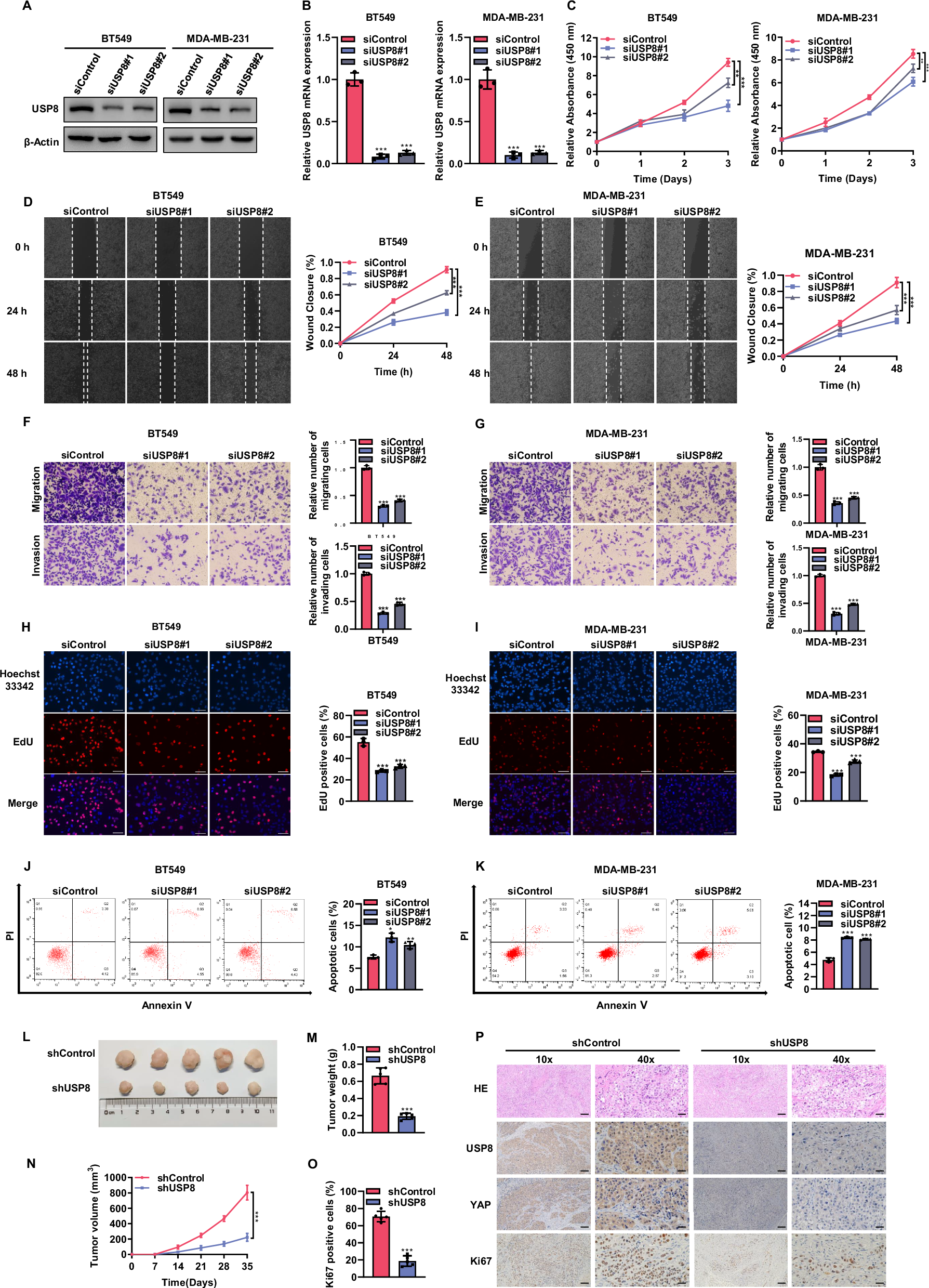 Fig. 2: Knocking down USP8 inhibits the progression of TNBC.