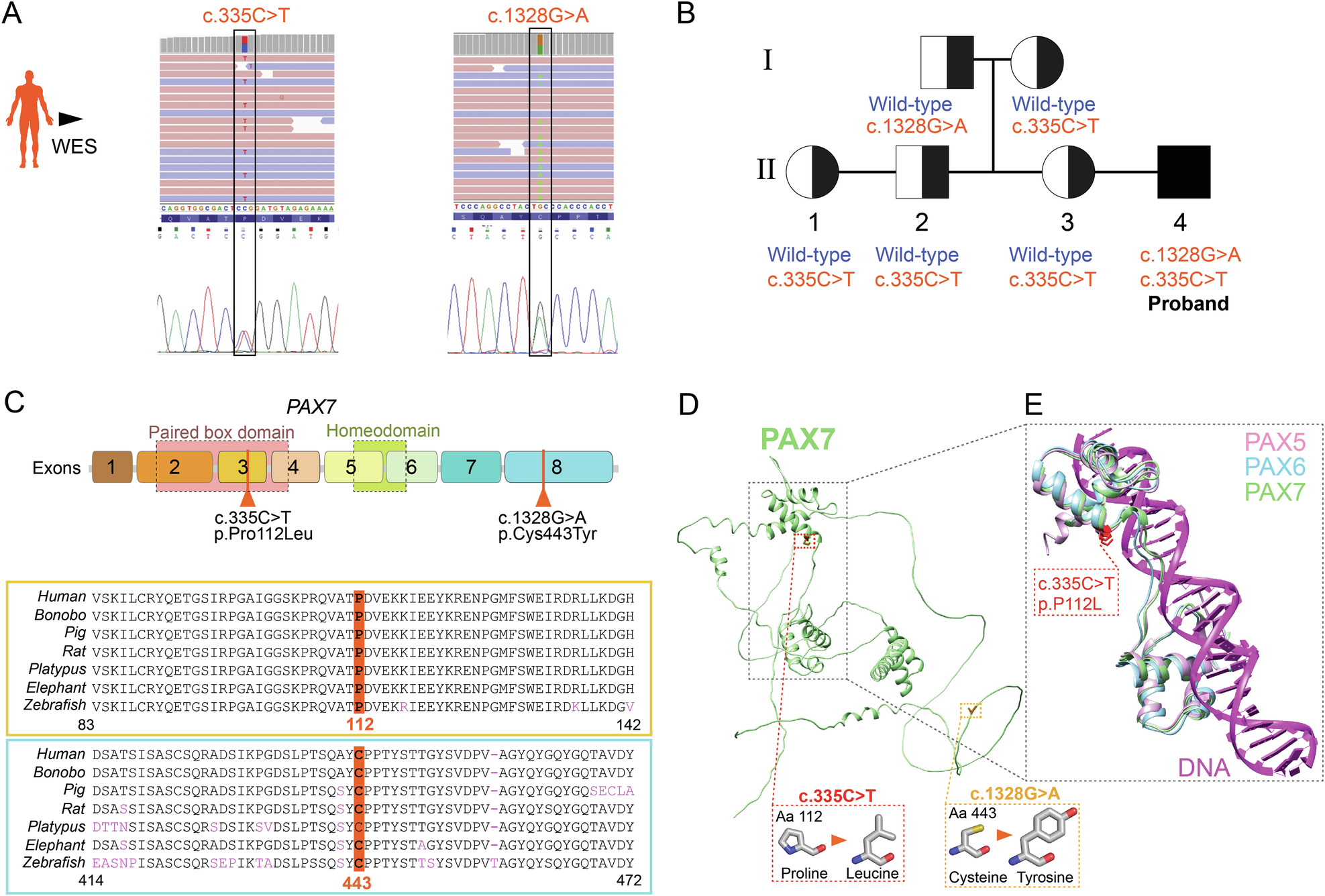 Fig. 2: Genomic analysis reveals compound heterozygous alleles in PAX7.