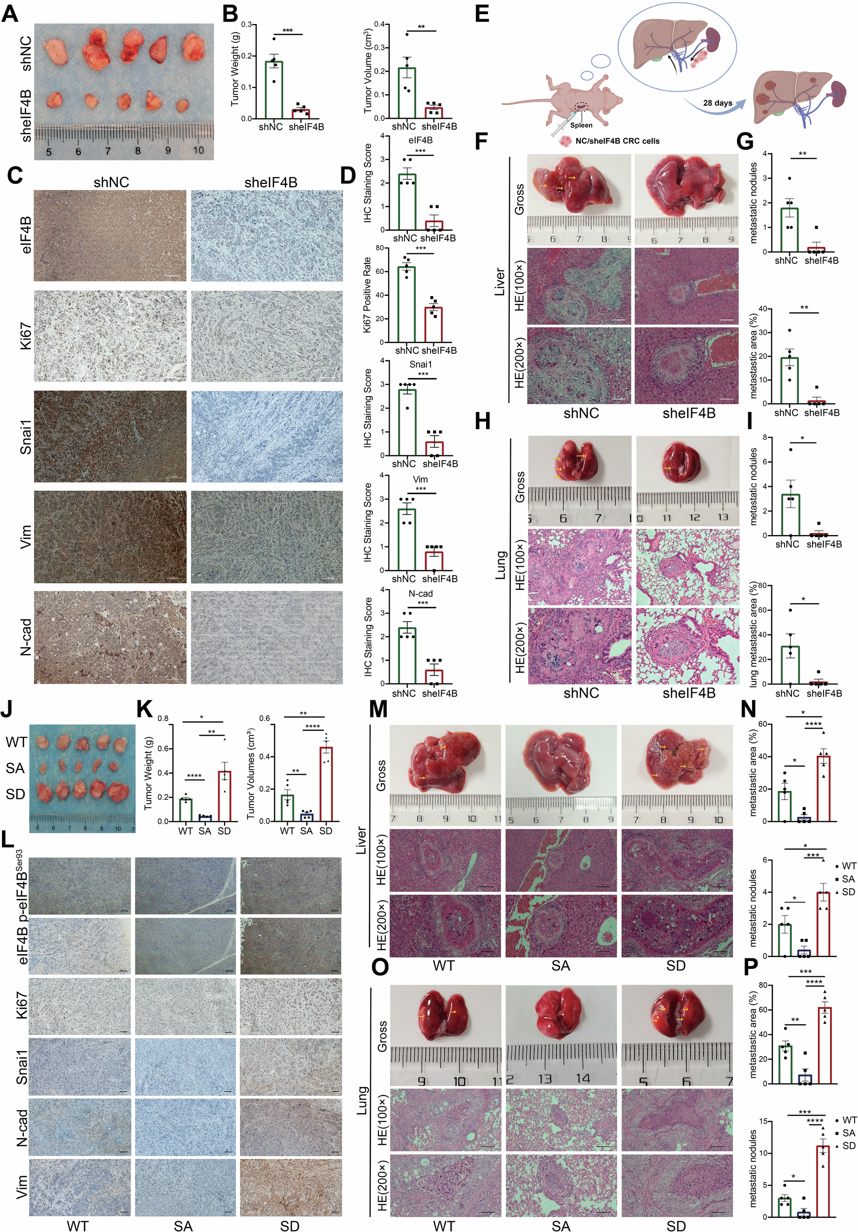 Fig. 5: eIF4B knockdown inhibited CRC growth and metastasis, while Ser93 phosphorylation promoted these processes in vivo.