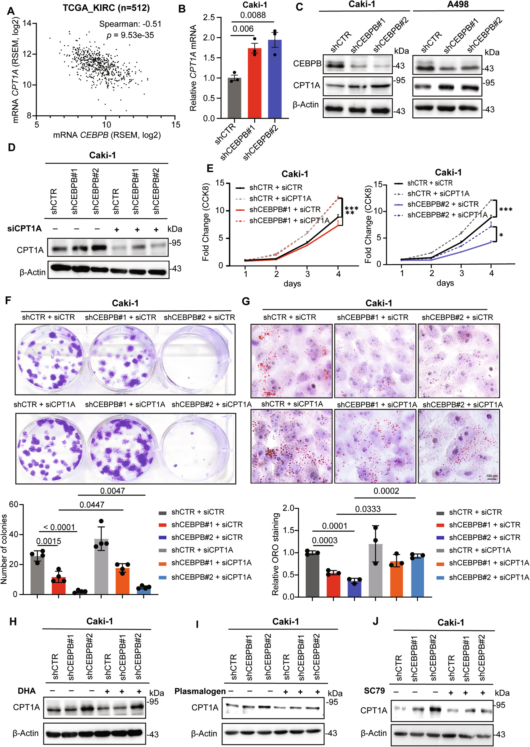 Fig. 6: CEBPB inhibits CPT1A expression via Akt activity.