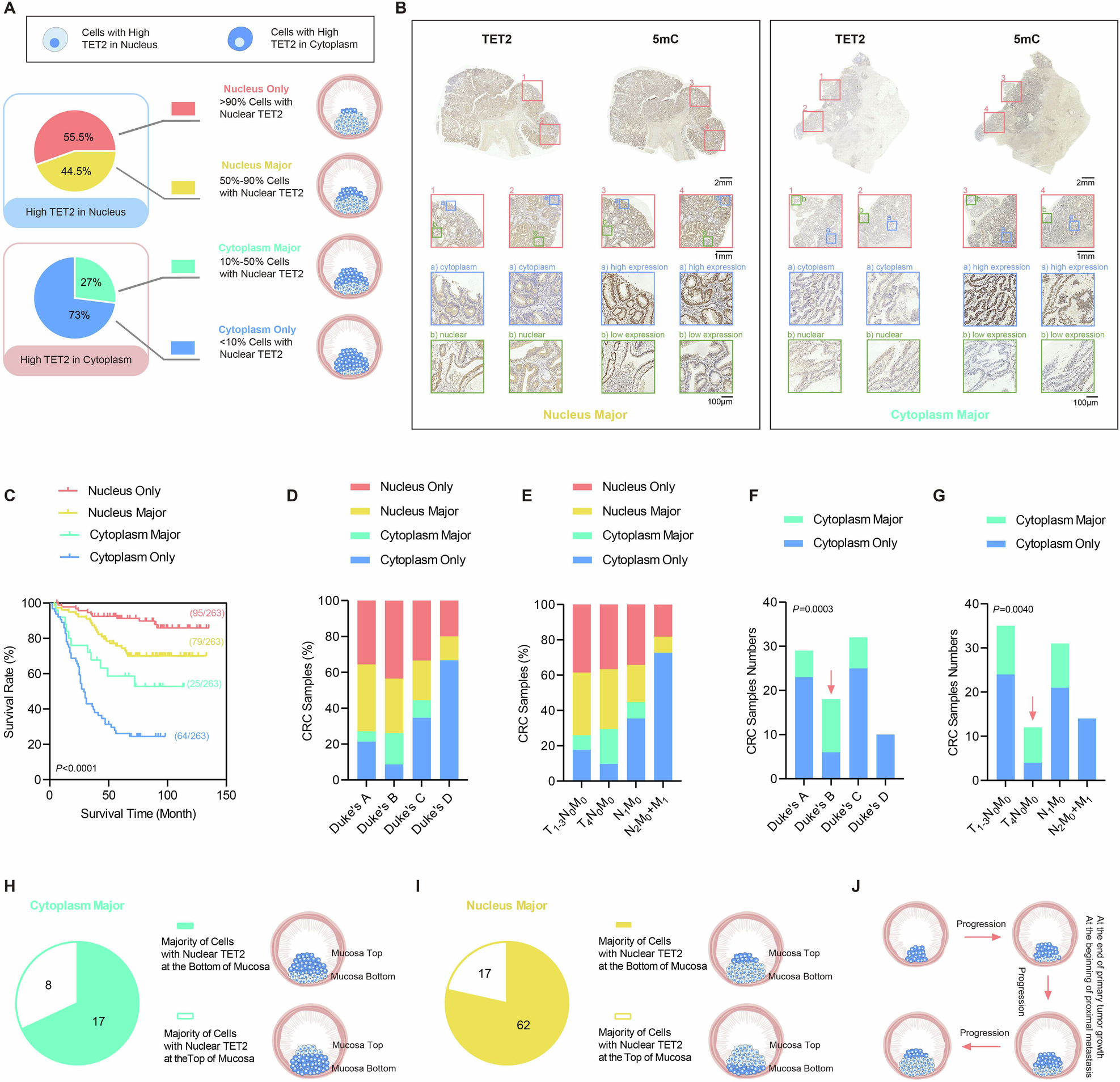 Fig. 1: Mosaic localization pattern of TET2 is observed in CRC tissues.