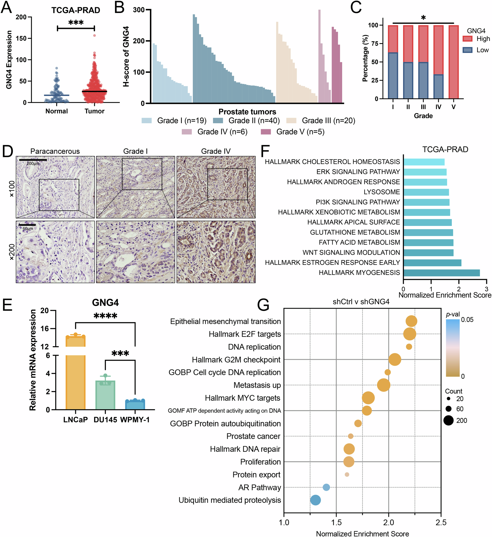 Fig. 1: GNG4 expression is upregulated and associated with more aggressive grade type in prostate cancer.