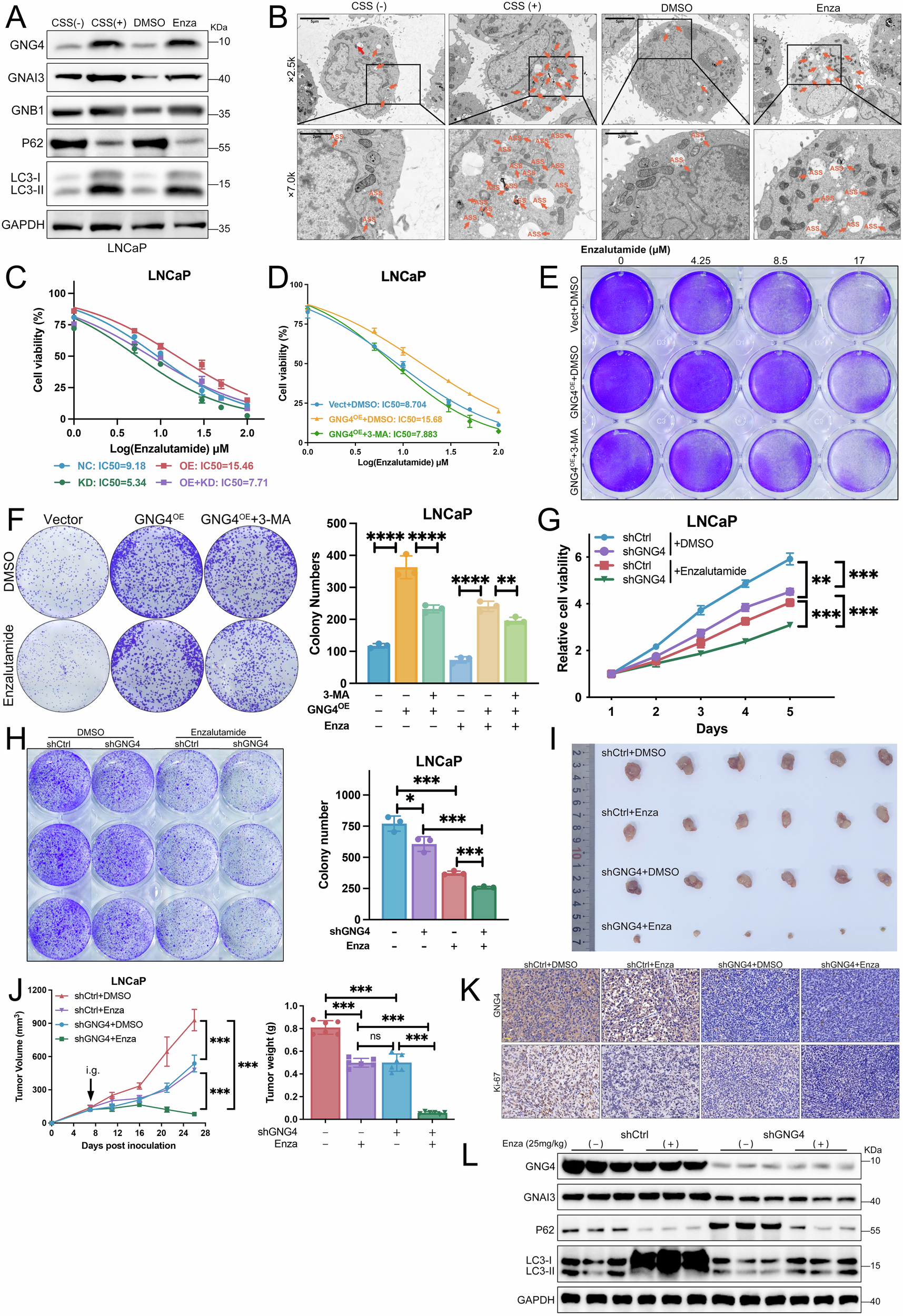 Fig. 6: GNG4–autophagy axis regulates the response to enzalutamide in prostate cancer.