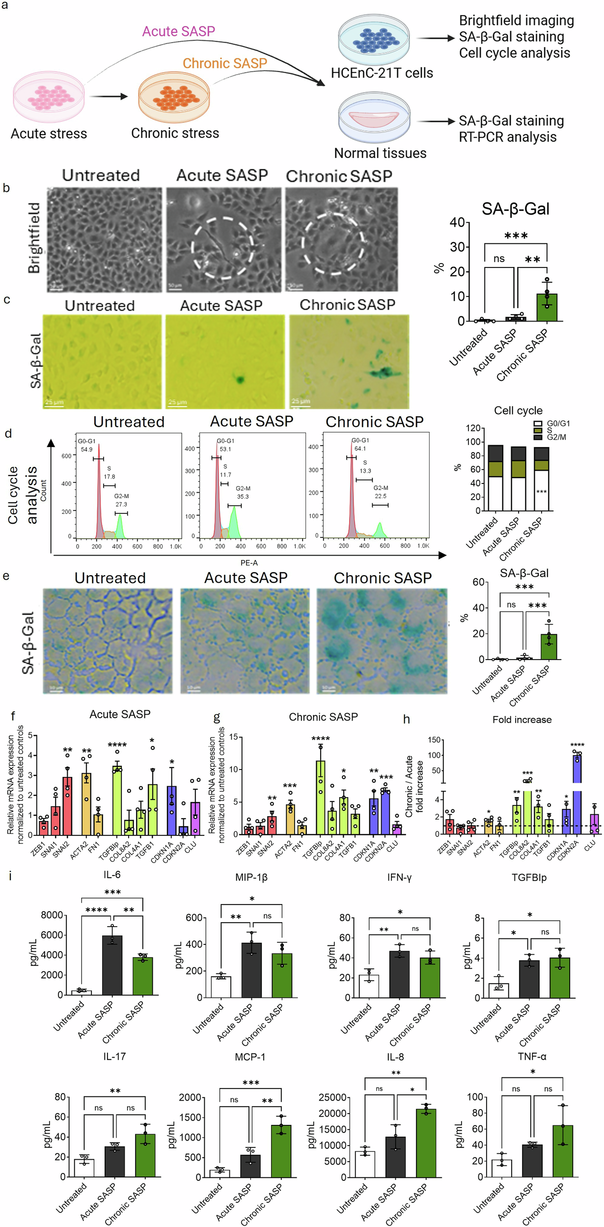 Fig. 4: Chronic stressed-induced senescence associated secretory phenotype (SASP) promotes senescence and fibrosis, as observed in FECD.