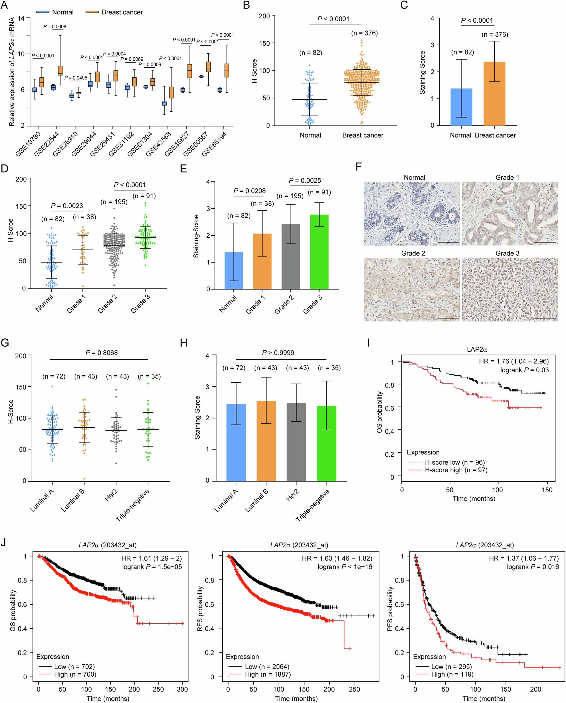 Fig. 1: LAP2α is implicated in breast tumorigenesis.
