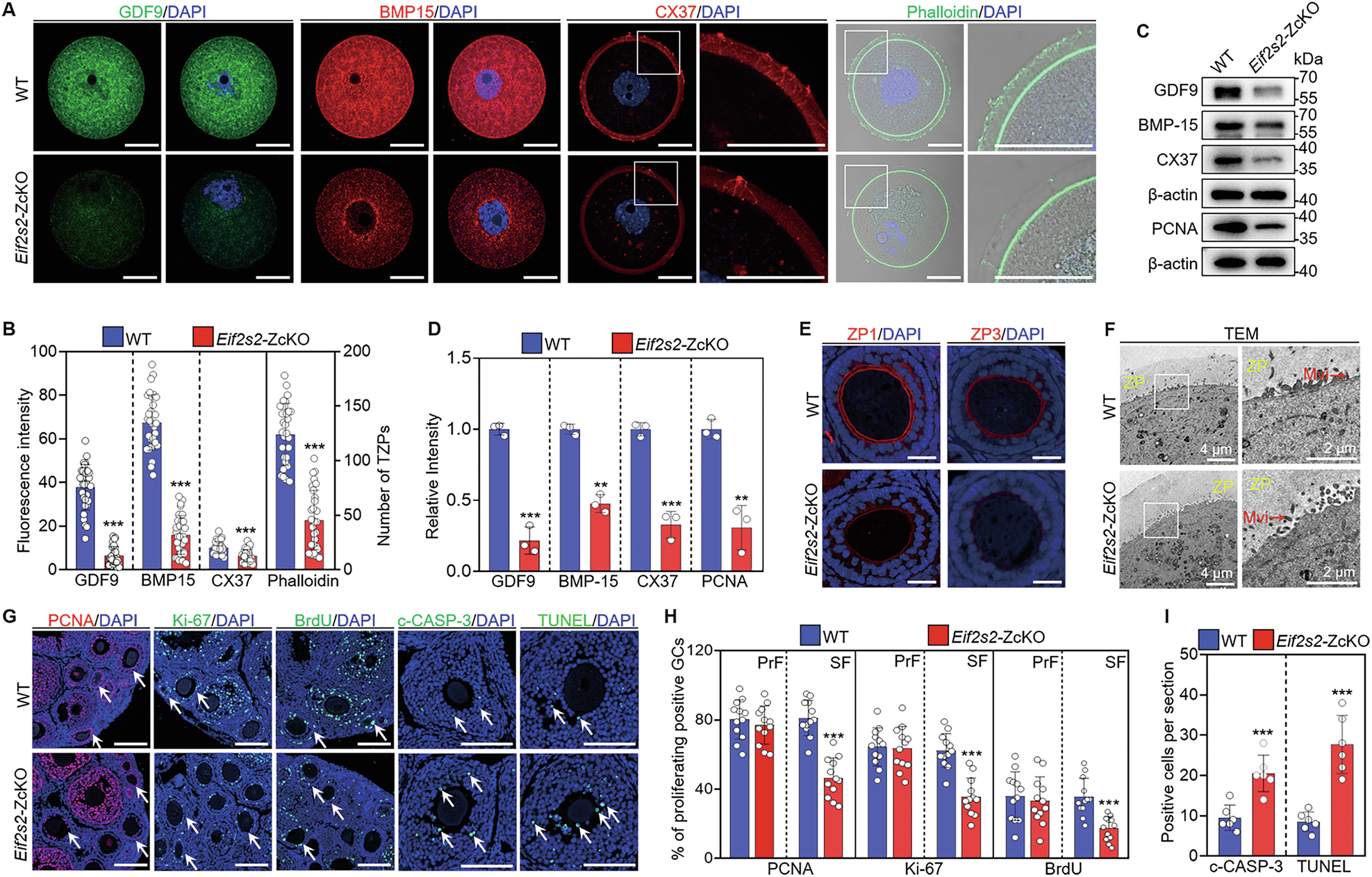 Fig. 3: Depletion of Eif2s2 in oocytes impairs granulosa cell proliferation and induces apoptosis.