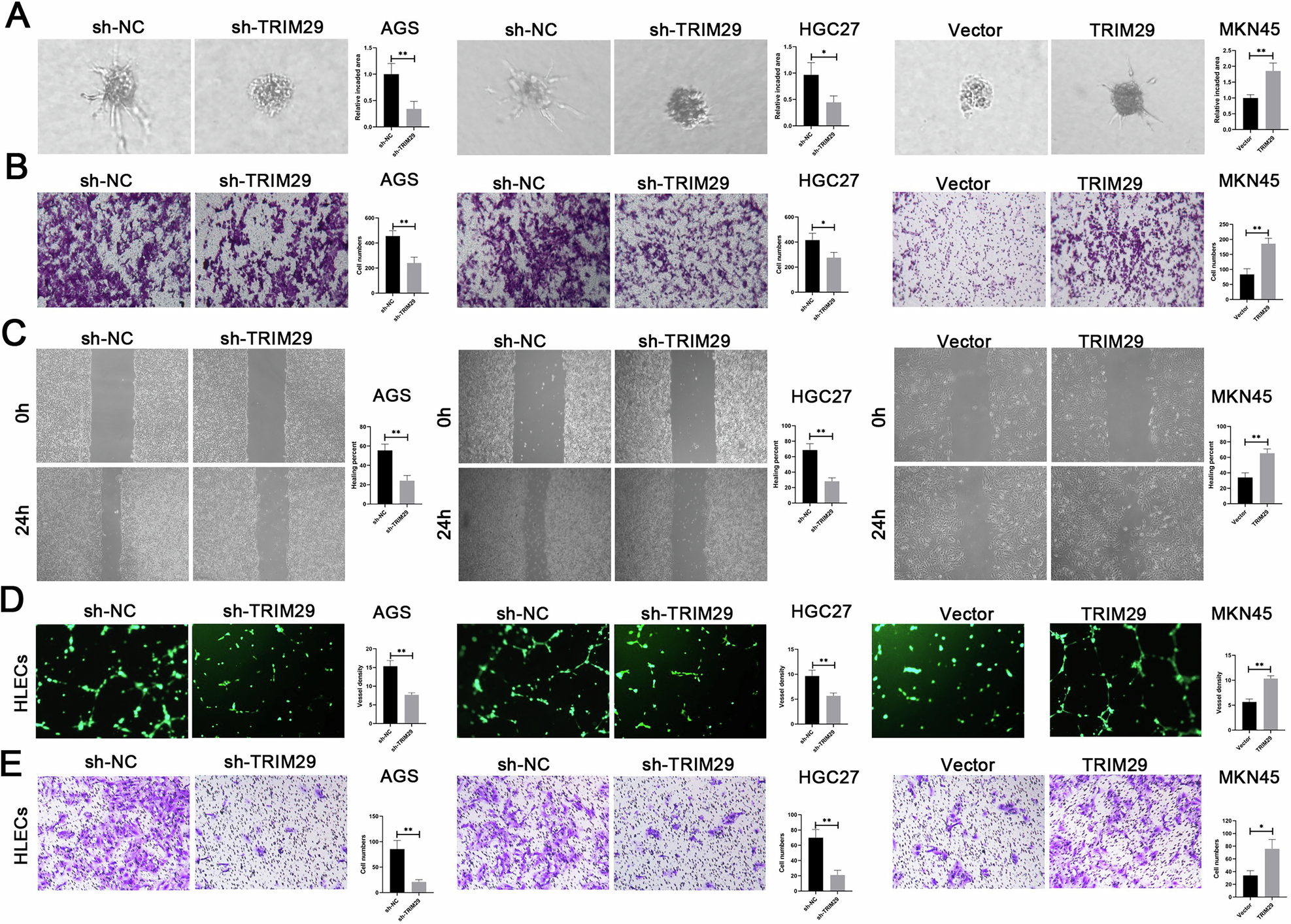 Fig. 2: TRIM29 induces metastasis and lymphangiogenesis in GC in vitro.