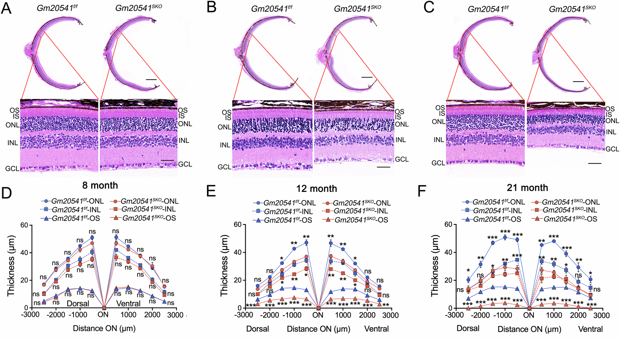 Fig. 3: Progressive retinal dystrophy in Gm20541SKO mice.