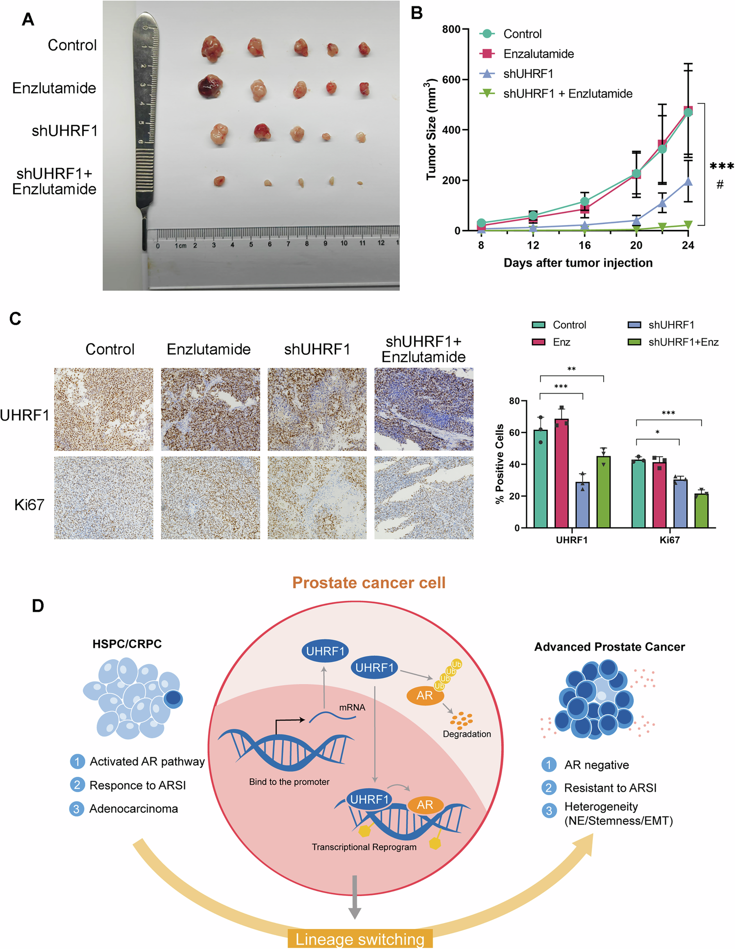 Fig. 5: Inhibition of UHRF1 demonstrates potential therapeutic value in the treatment of advanced prostate cancer.