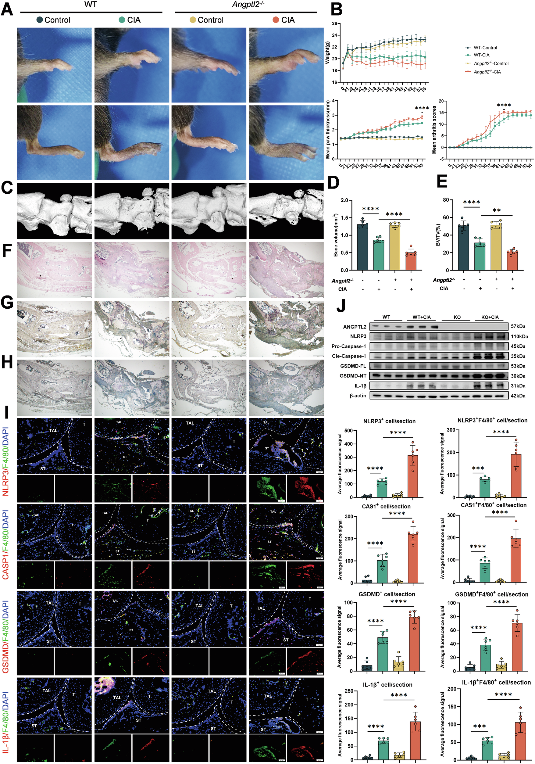 Fig. 1: ANGPTL2 deficiency exacerbates pyroptosis and joint damage in a mouse model of rheumatoid arthritis.