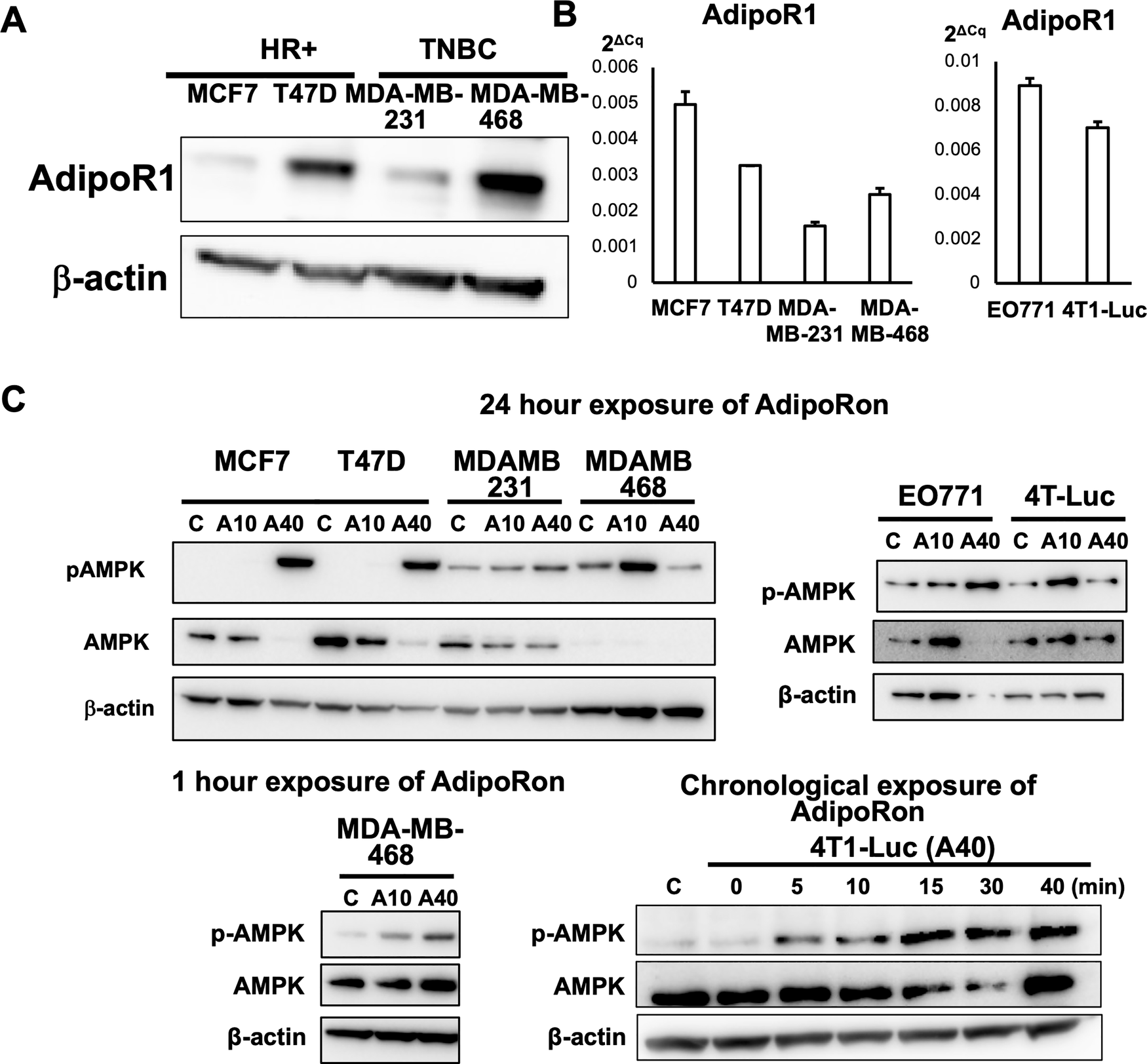 Fig. 2: Breast cancer cell lines express AdipoR1, and AdipoRon activates AdipoR1 signaling.