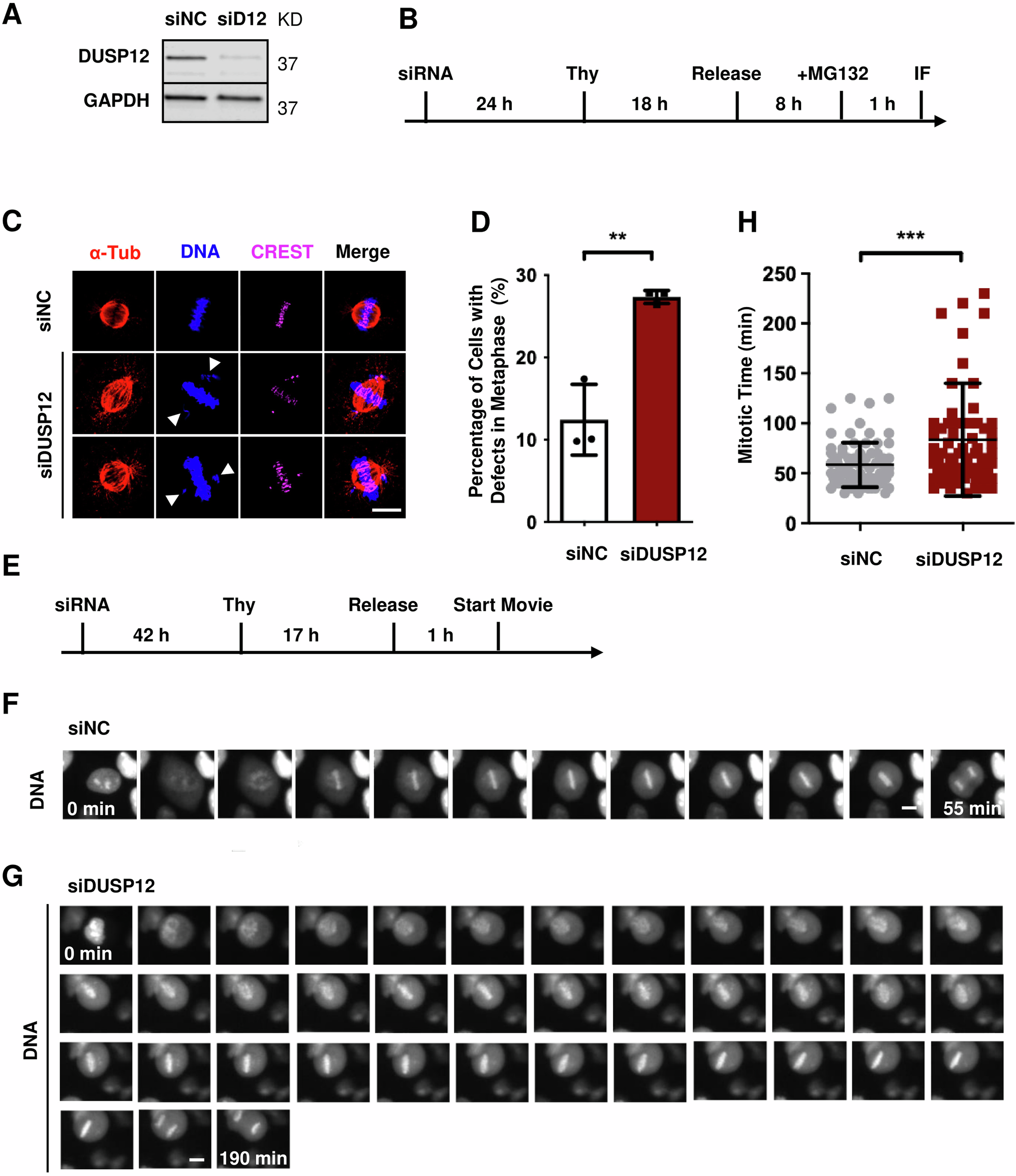 Fig. 1: Knockdown of DUSP12 leads to mitotic defects.