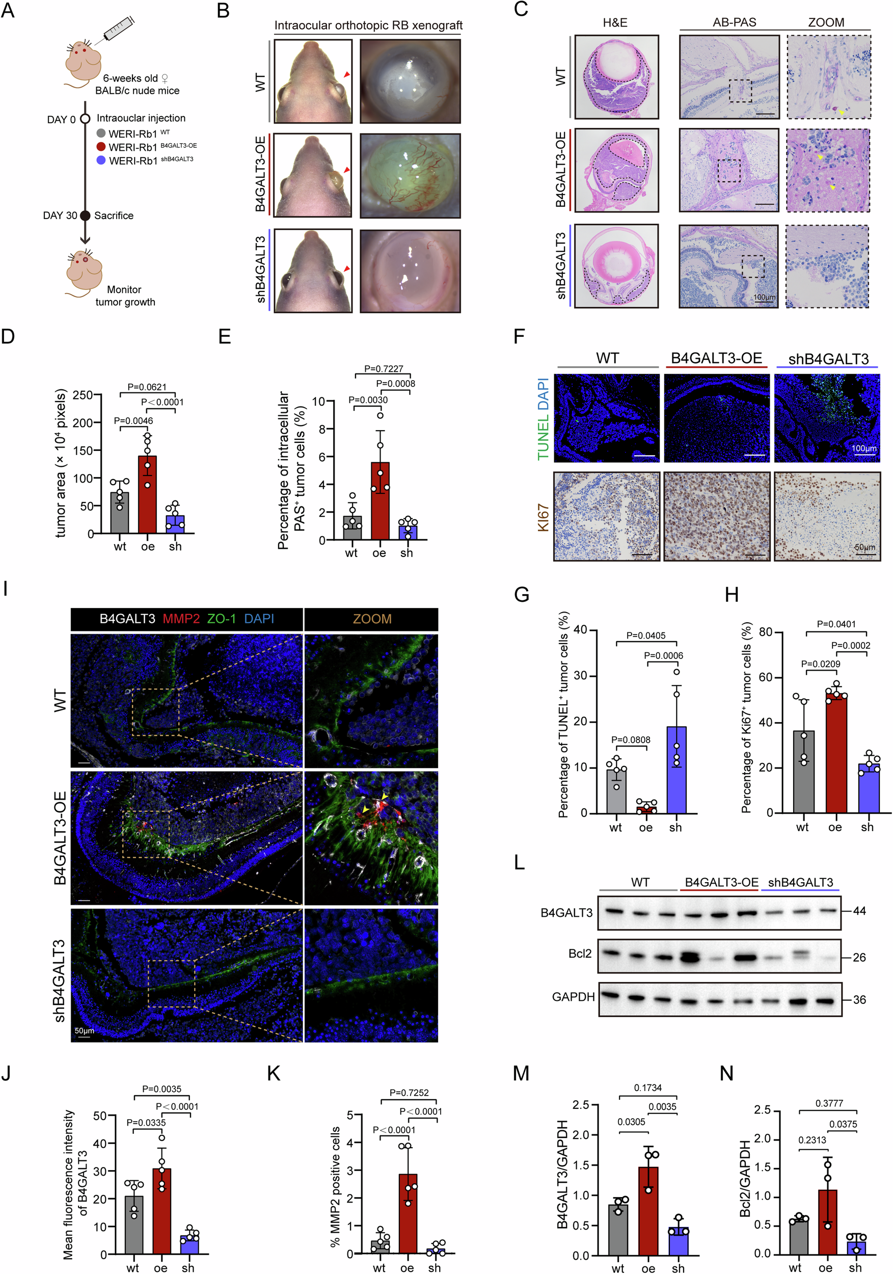 Fig. 5: B4GALT3 promotes retinoblastoma growth and invasion in vivo.