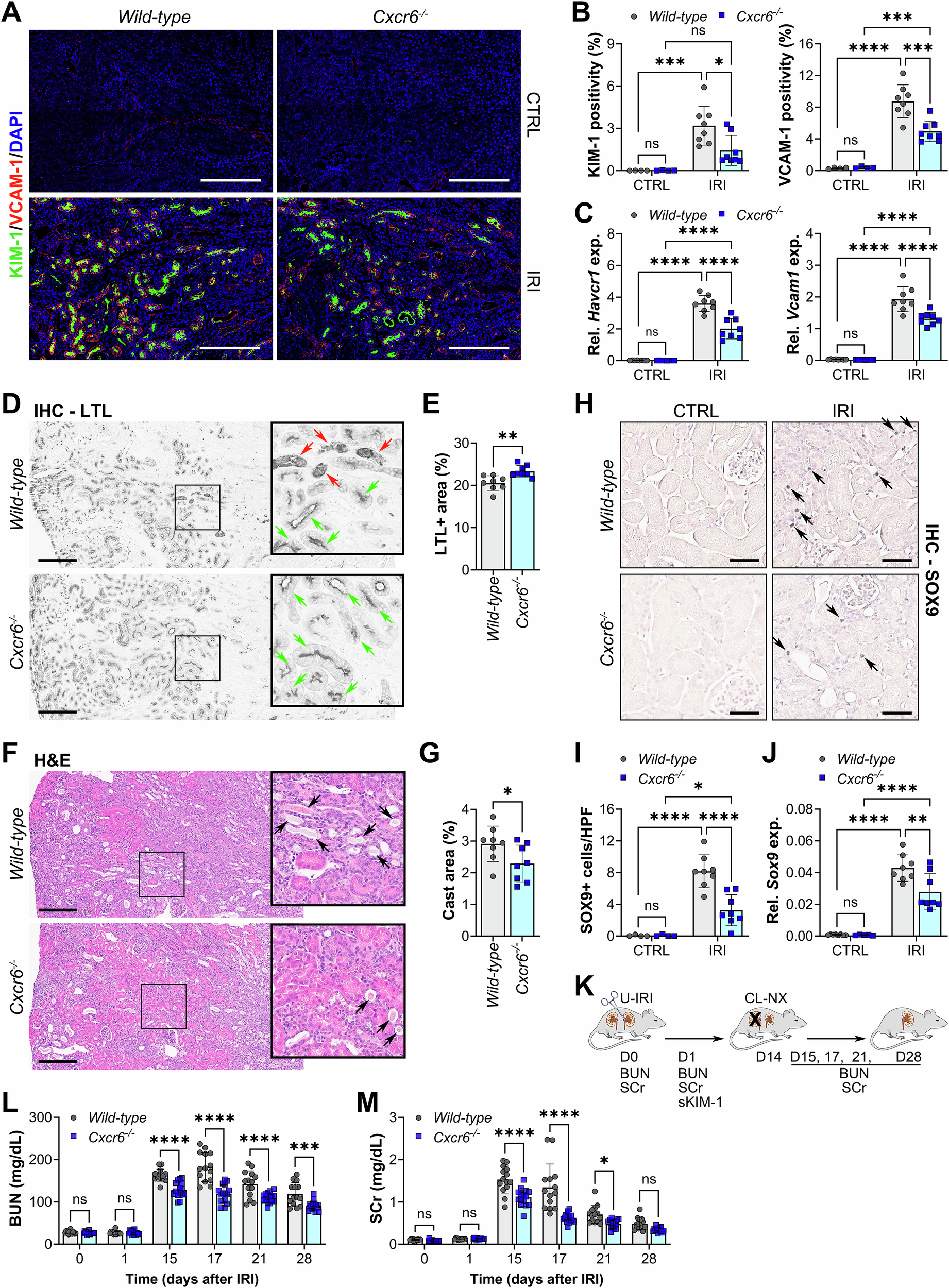 Fig. 5: CXCR6 impairs renal function during maladaptive kidney repair.