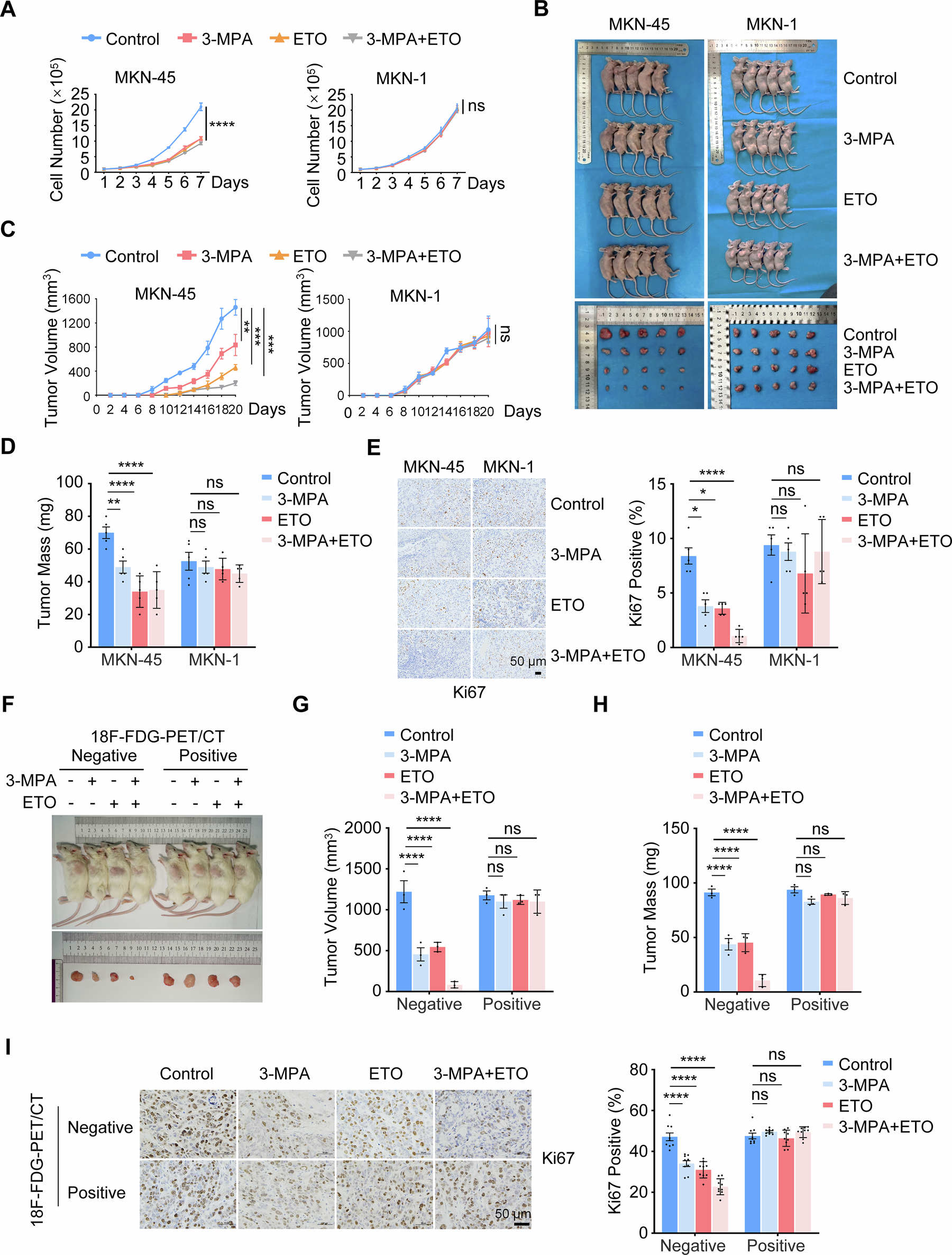 Fig. 6: Targeting PCK/CPT1A axis slows down tumor growth of 18F-FDG-PET/CT-negative gastric cancer.