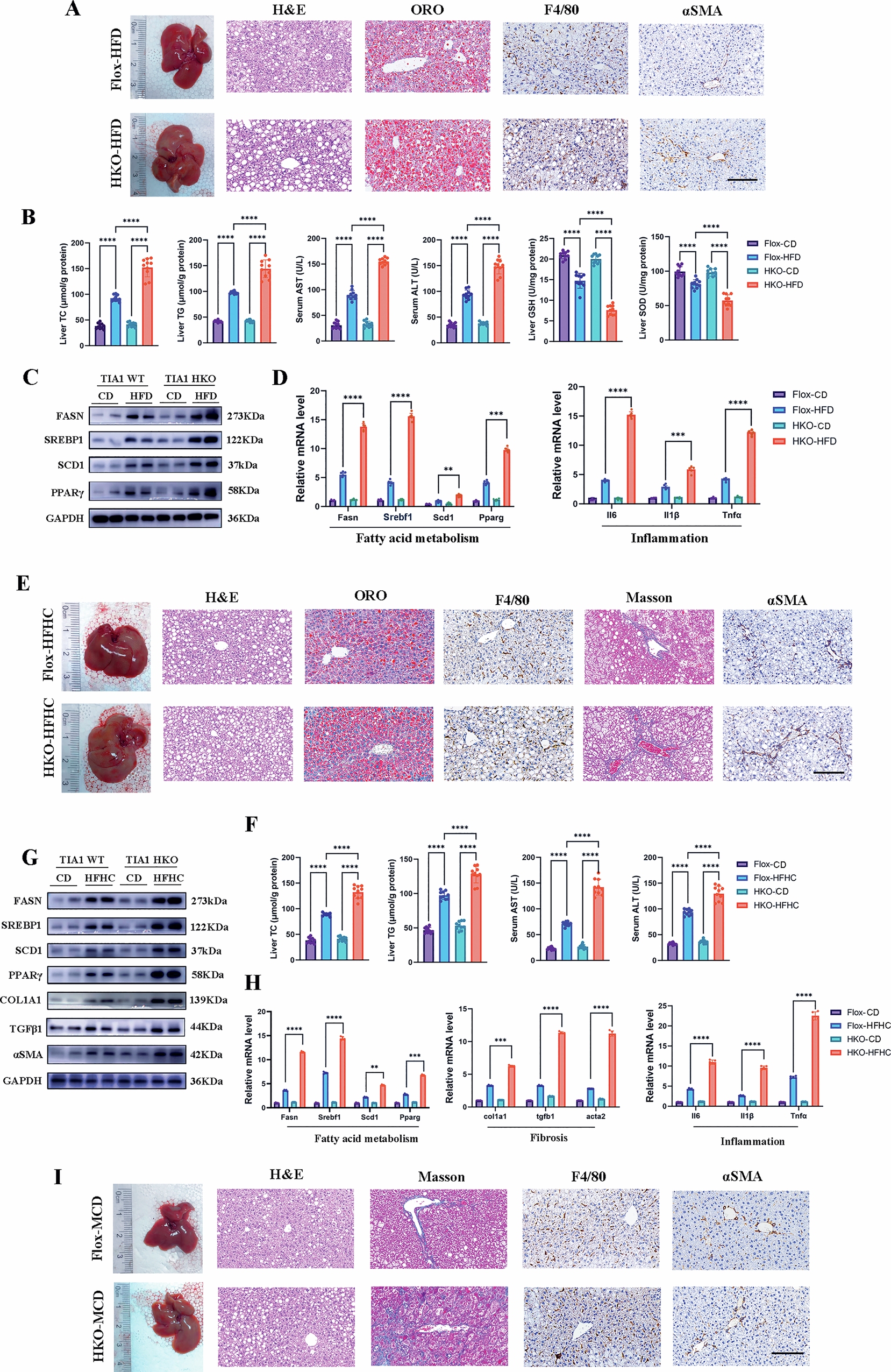Fig. 2: Hepatocyte-specific TIA1 deletion exacerbates die-induced hepatic steatosis, inflammation and fibrosis.
